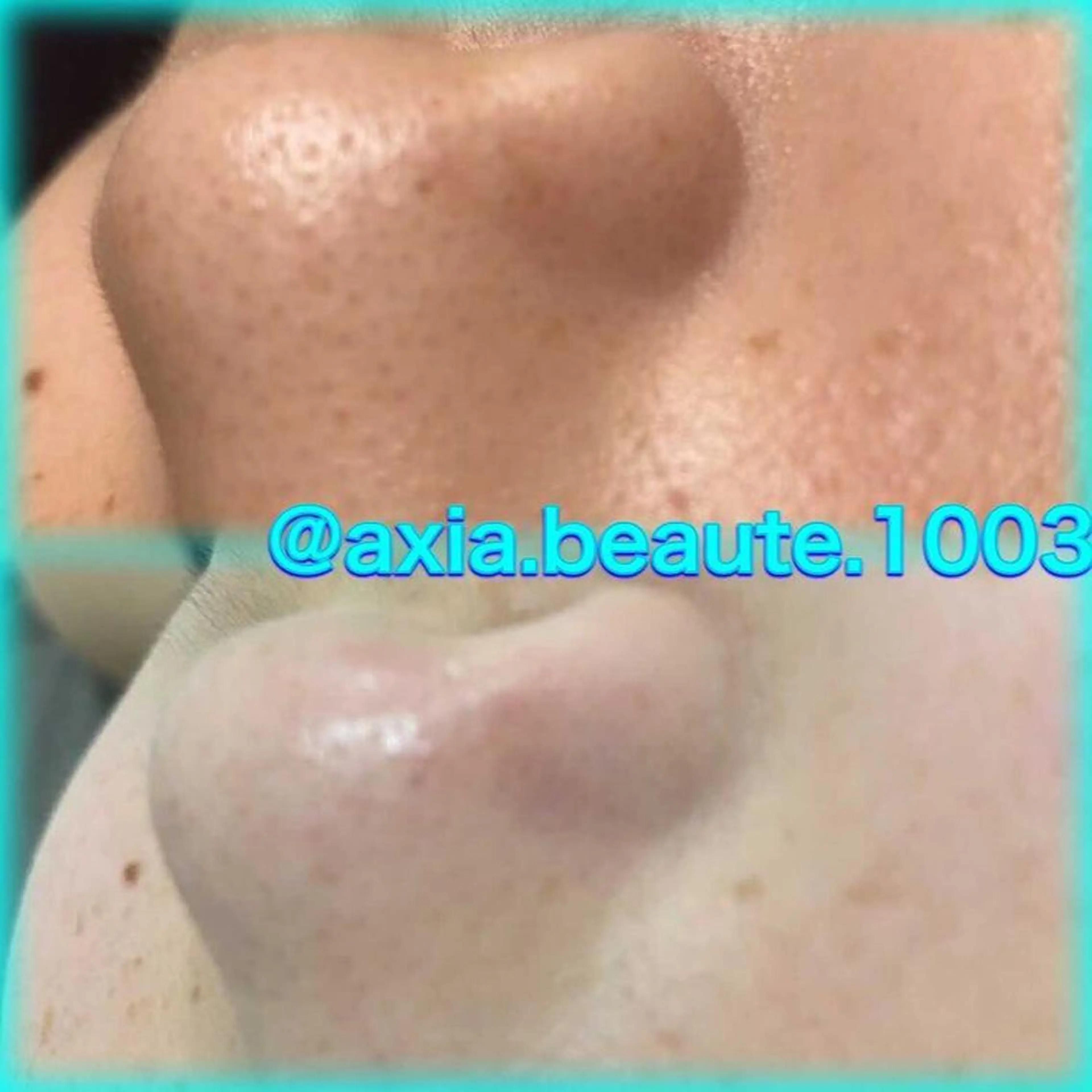 メンズ アクシア ビューティー サロン所属・究極のアンチエイ ジングサロンのエステ・リラクイメージ