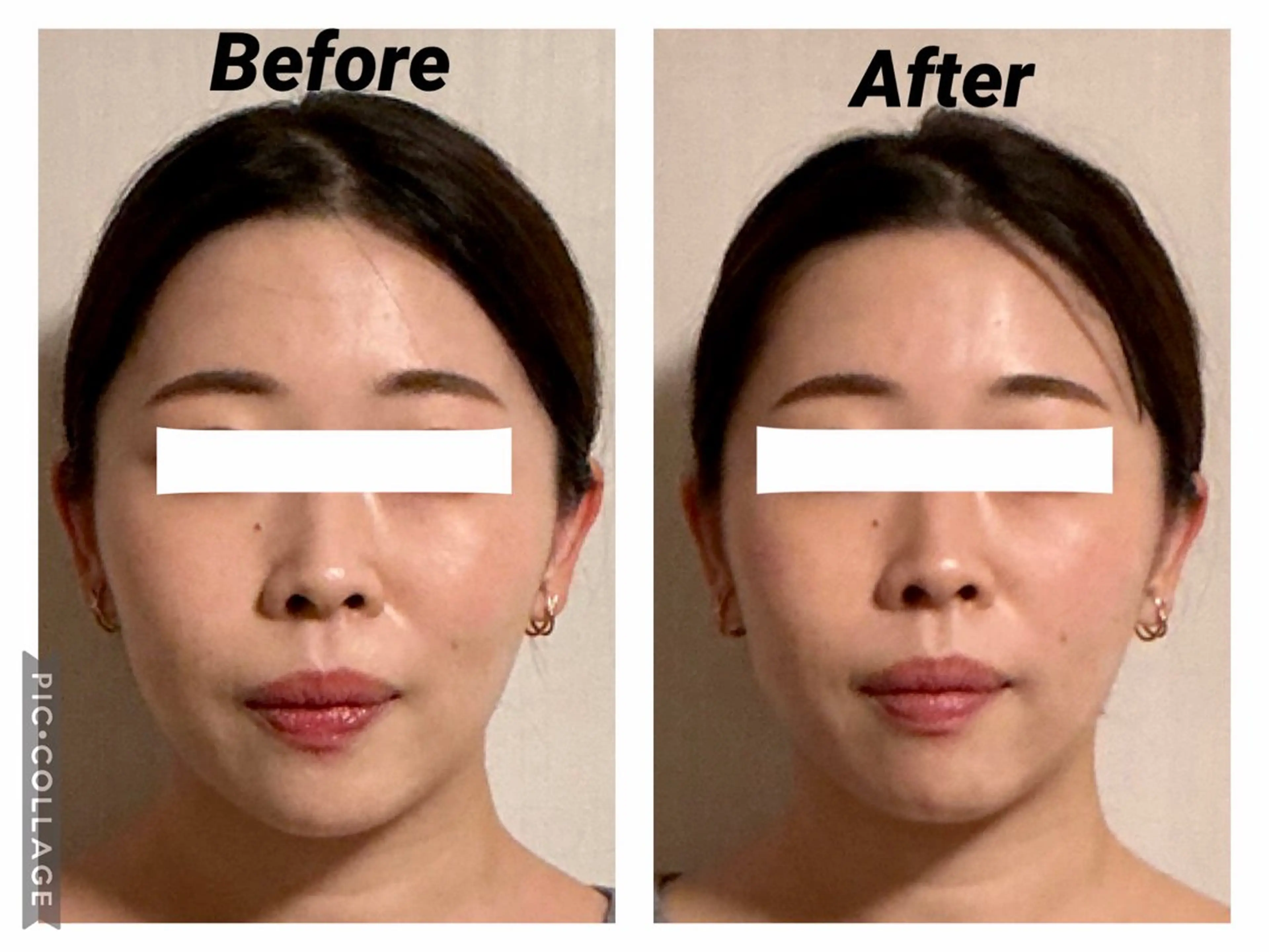 エステ リラク 小顔矯正Sho  FaceDesignのエステ・リラクイメージ