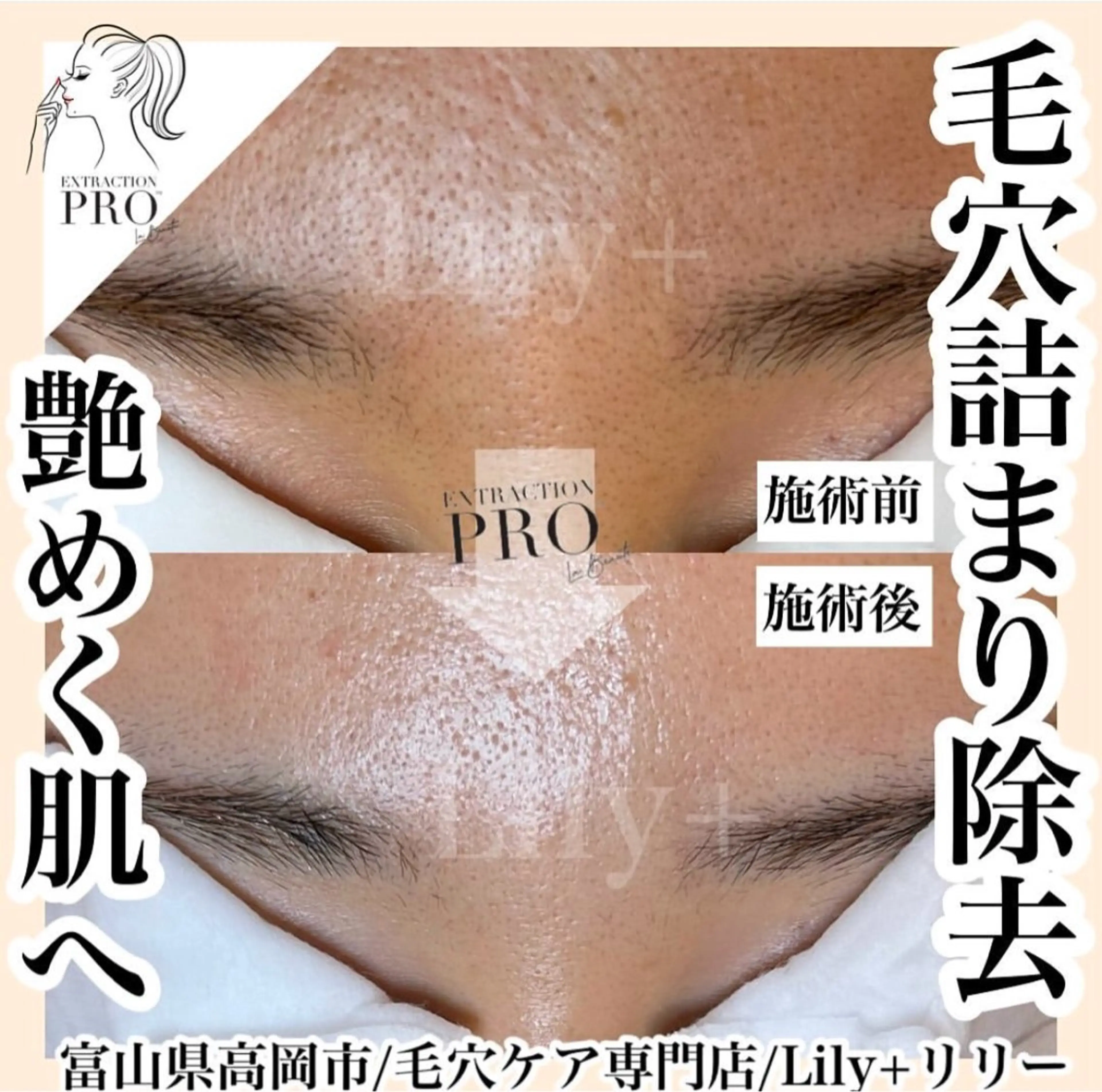 リリー yuriのエステ・リラクイメージ