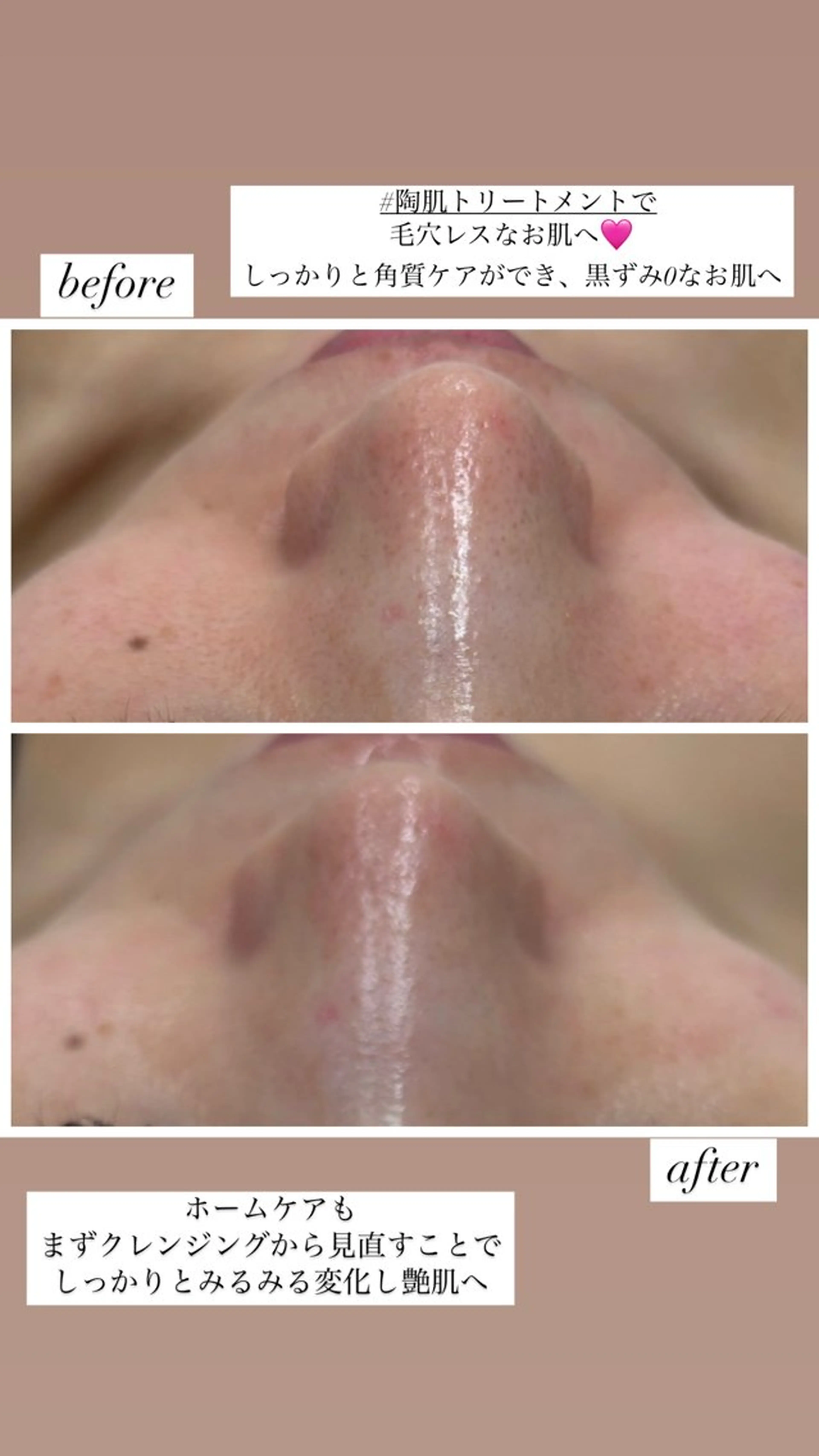 エステ ニキビ毛穴専門店Beautysalon Luana所属・小林 まいのエステ・リラクイメージ