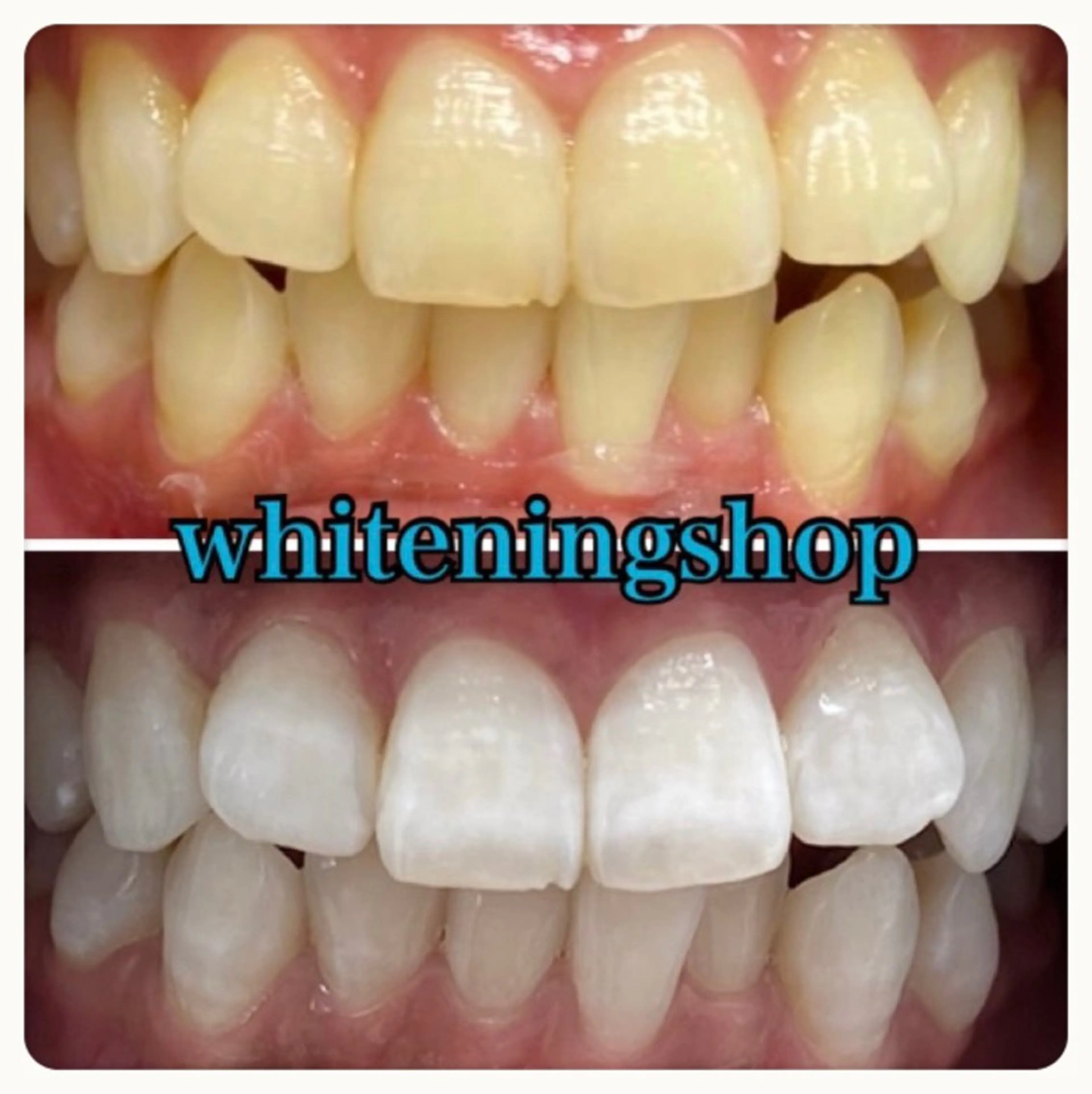 エステ リラク ホワイトニング ショップ吉祥寺店のエステ・リラクイメージ