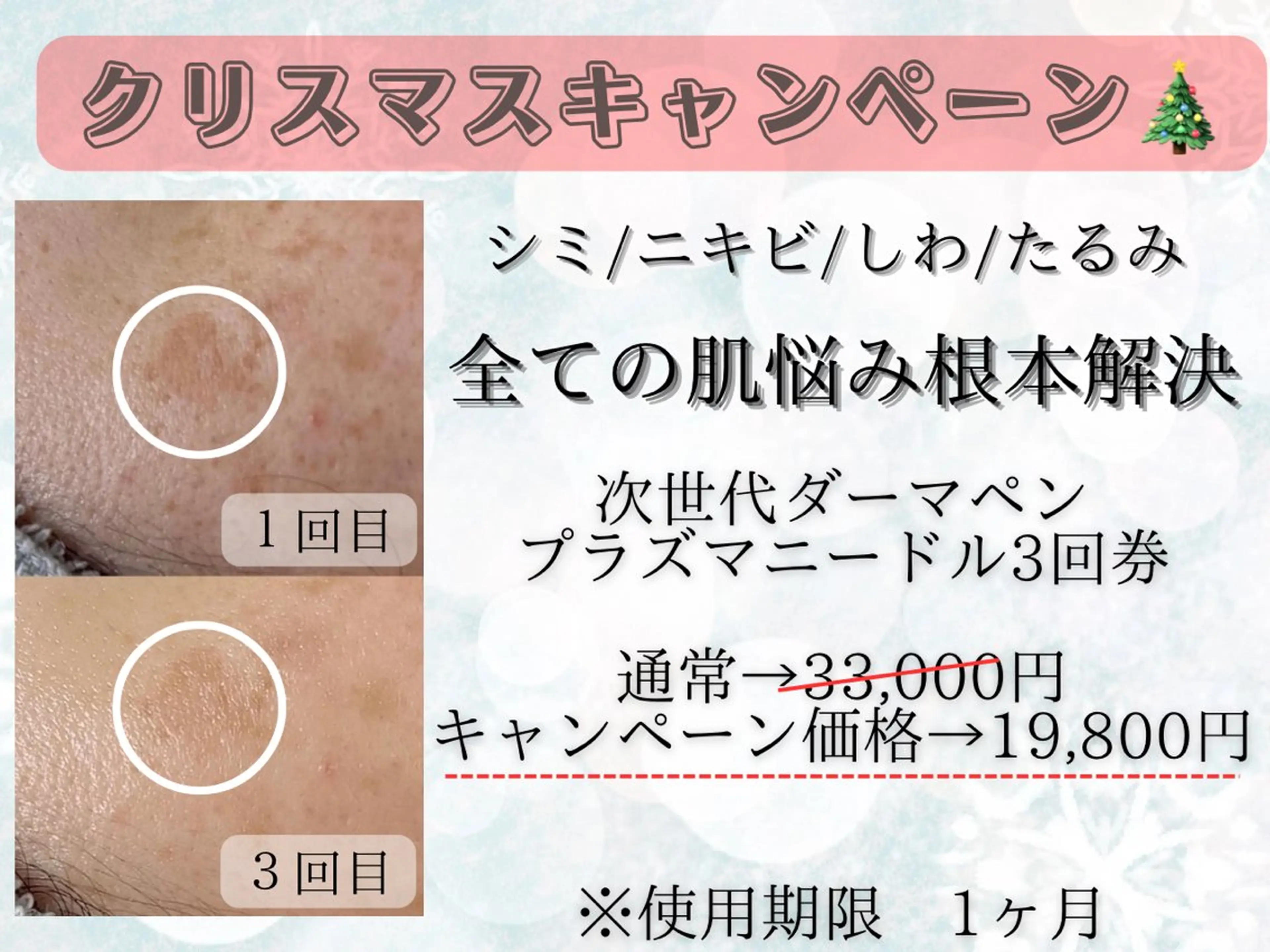 Rairy所属・Rairy Salon富士見町のエステ・リラクイメージ