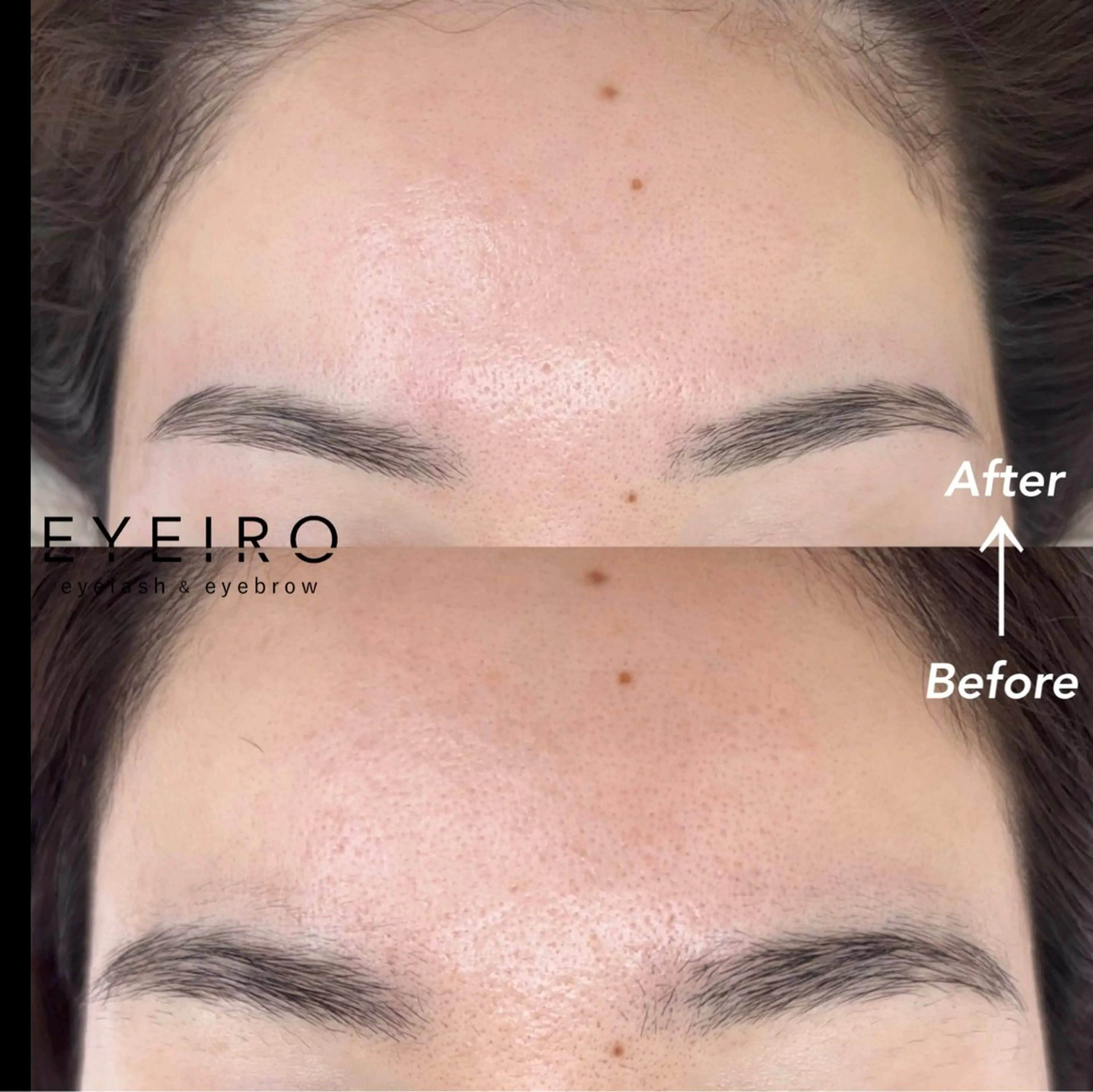 脱毛 EYEIRO大宮東口 Chibaのマツエク・マツパデザイン