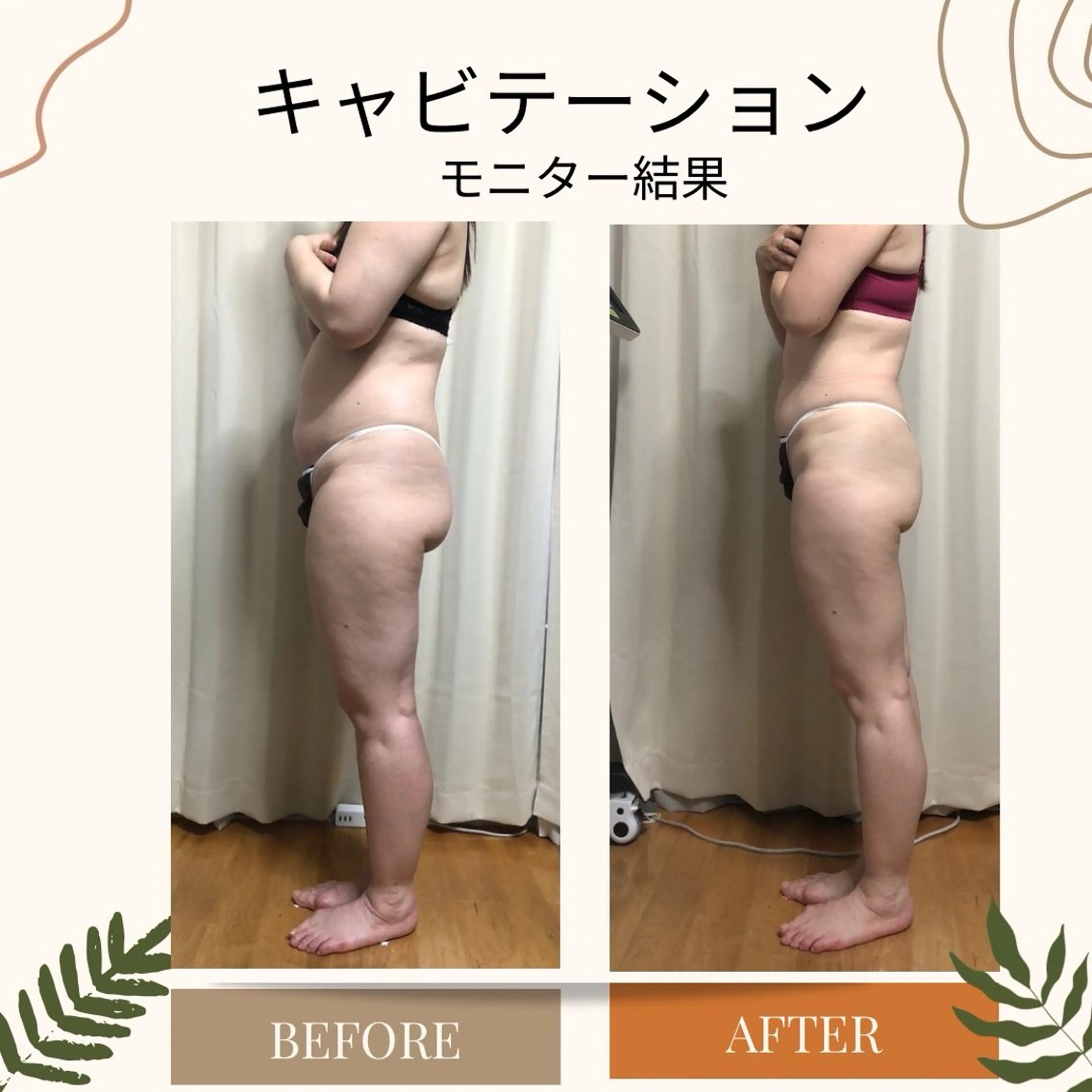 WISH 美肌脱毛のプロ！須藤のエステ・リラクイメージ