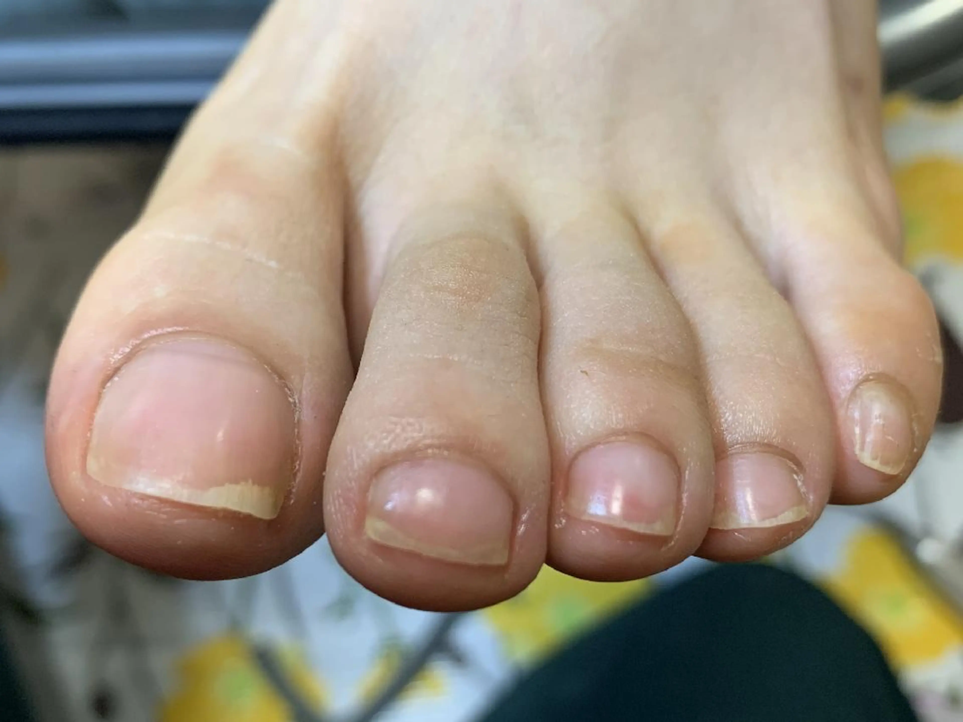 carenail　 tsugumiのその他イメージ