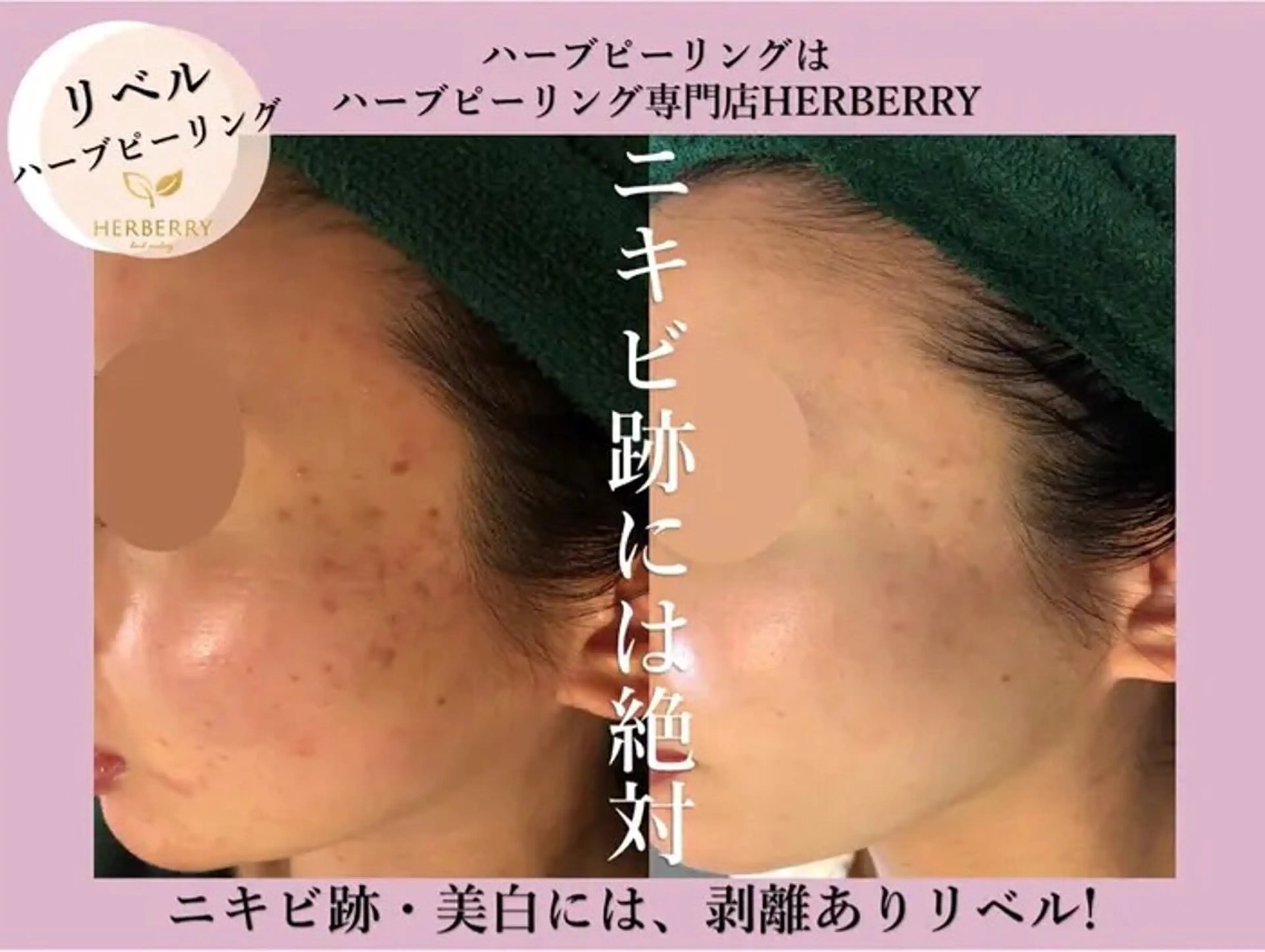 ハーブピーリング専門店HERBERRY難波心斎橋店所属・ハーブピーリング専門 HERBERRY冨永のエステ・リラクイメージ