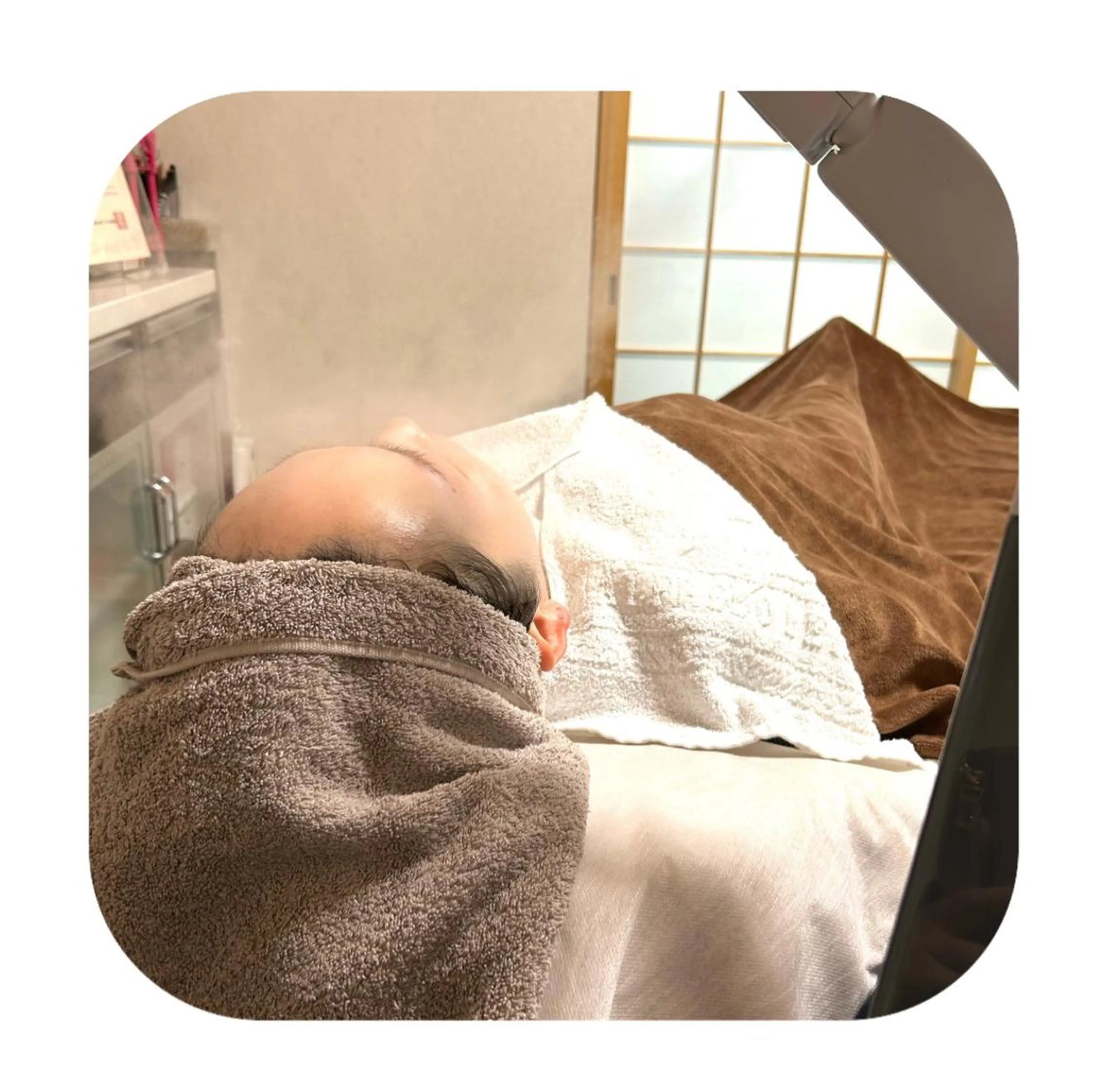 美肌エステの写真