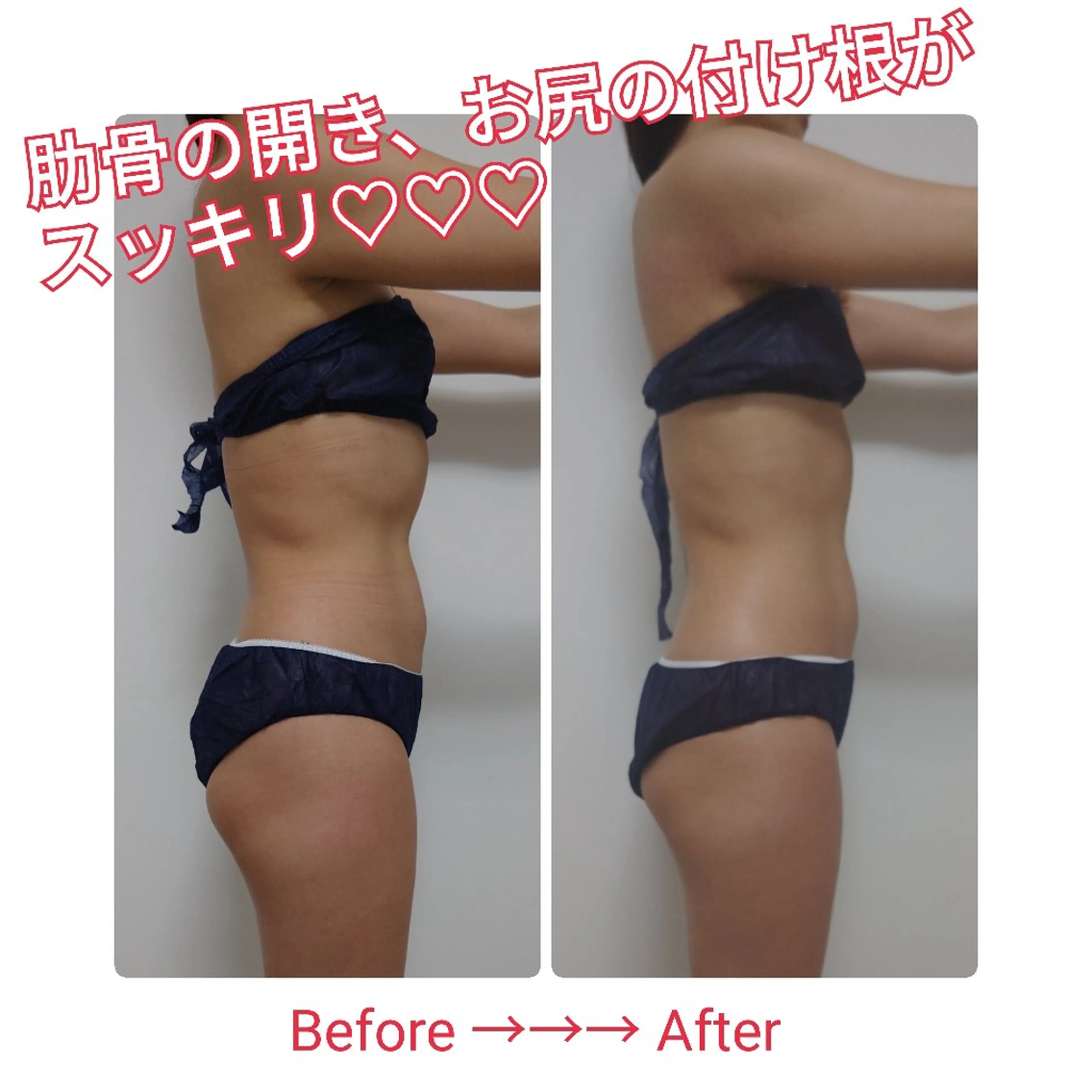 エステ private salon TOWA所属・東洋✖️西洋痩身 TOWA♡関内馬車道のエステ・リラクイメージ