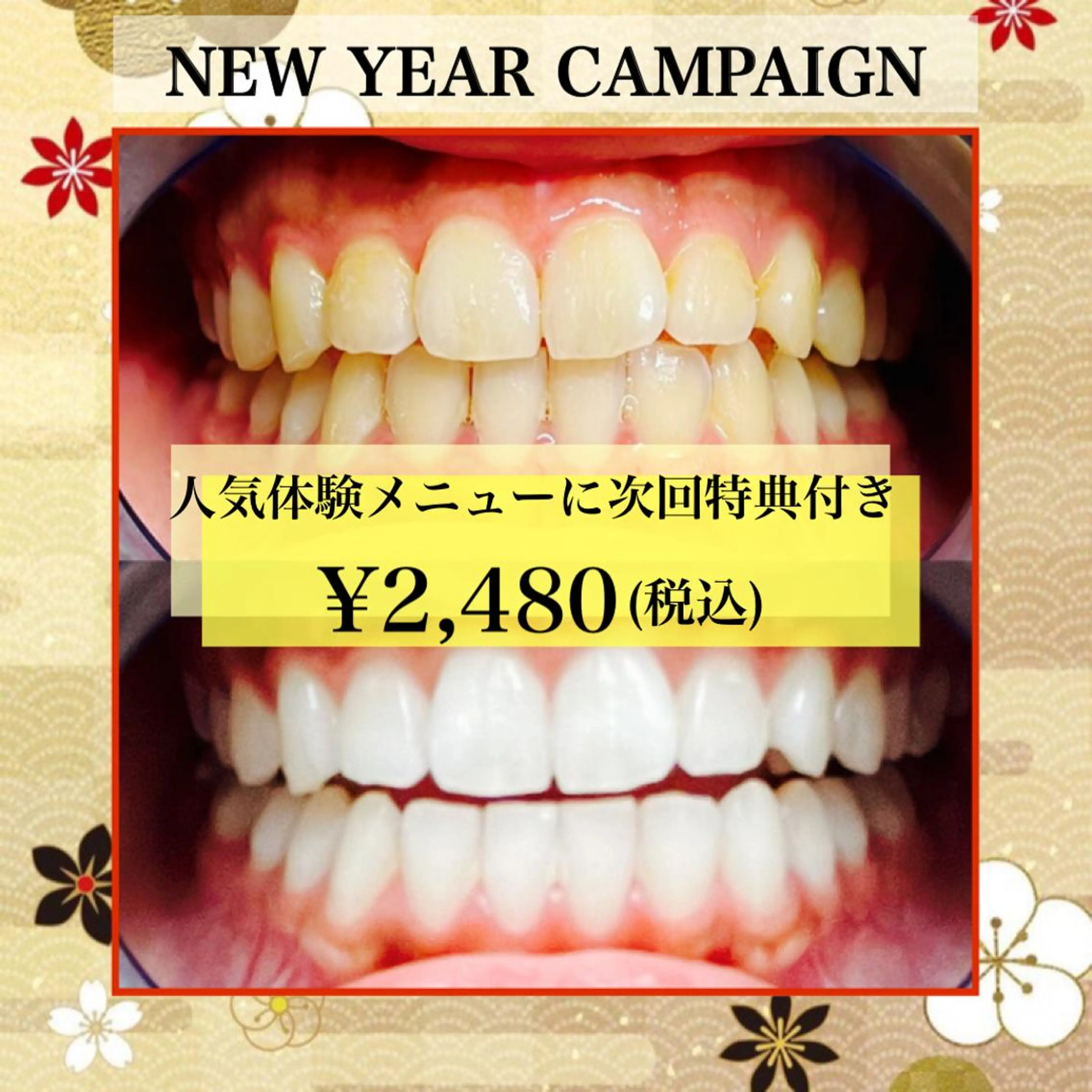 ホワイトニング専門店 LCS 銀座店 峰岡のその他イメージ