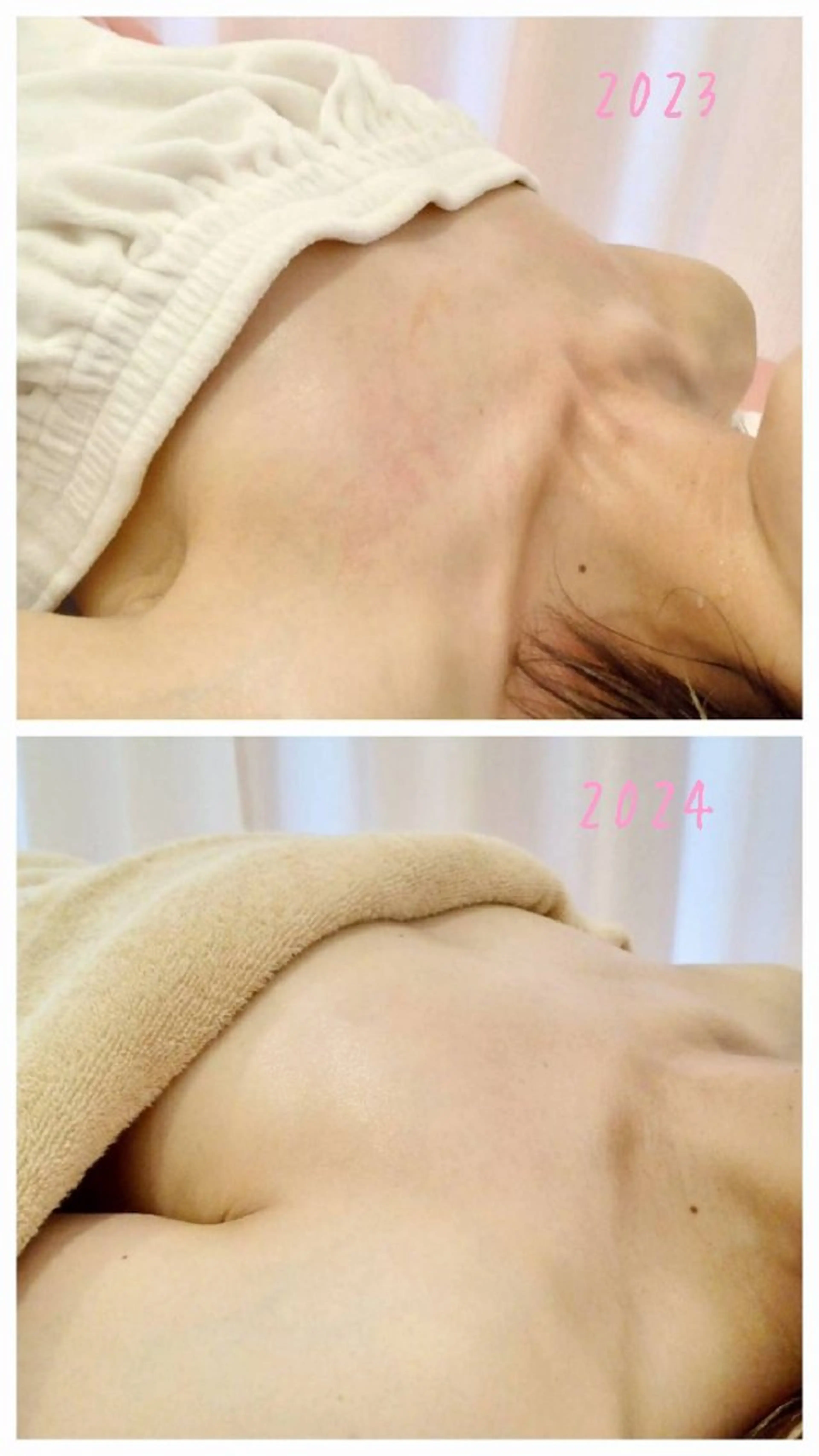 エステ マシュマロバスト coucouのエステ・リラクイメージ