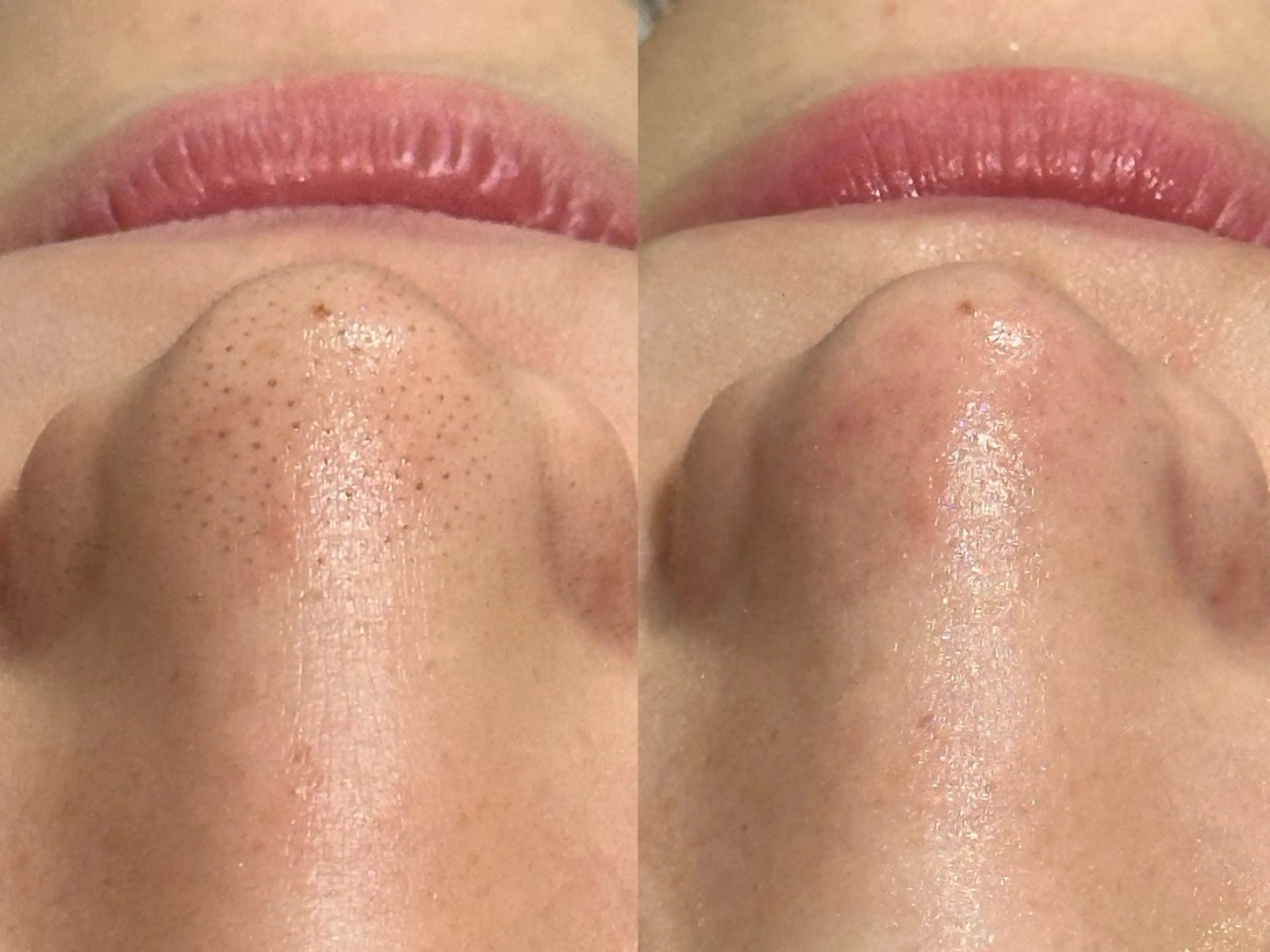 エステ mumu beautyのエステ・リラクイメージ