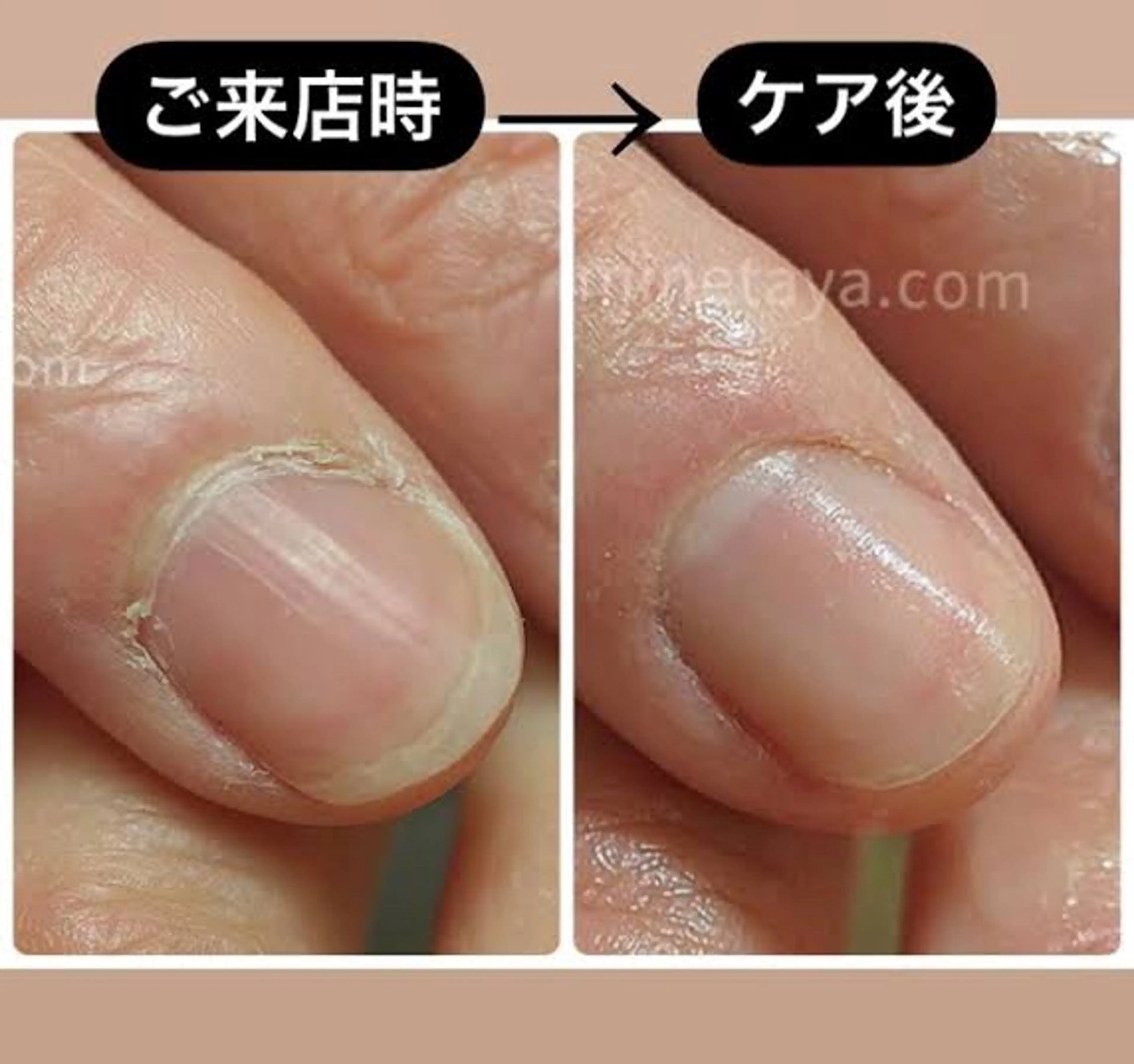 ﾌｯﾄｹｱのみ‼️(甘皮処理 爪の整形)　※オフは別途料金かかりますの写真