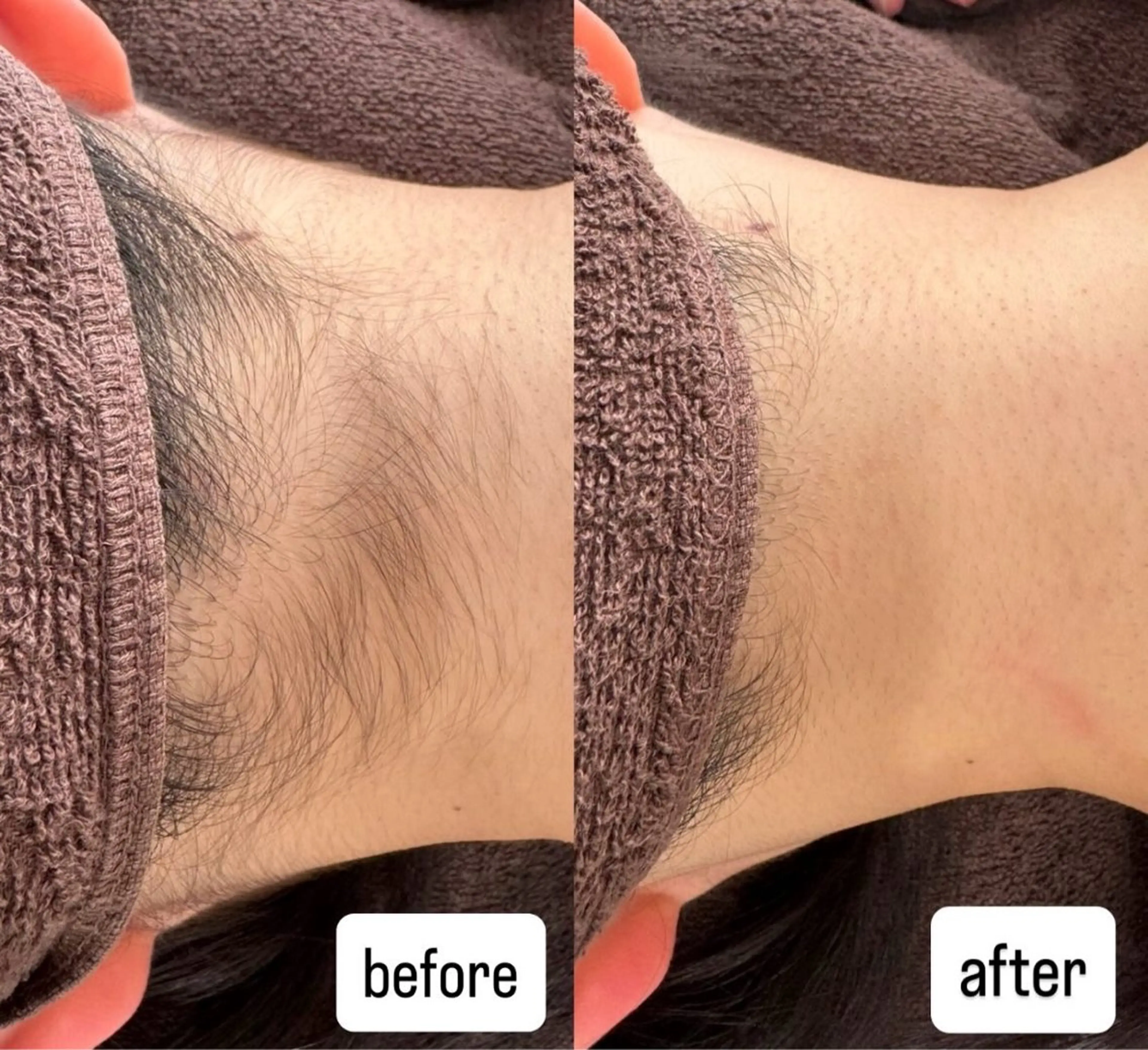 salonvilla所属・villa ☺︎草山 楓花のエステ・リラクイメージ