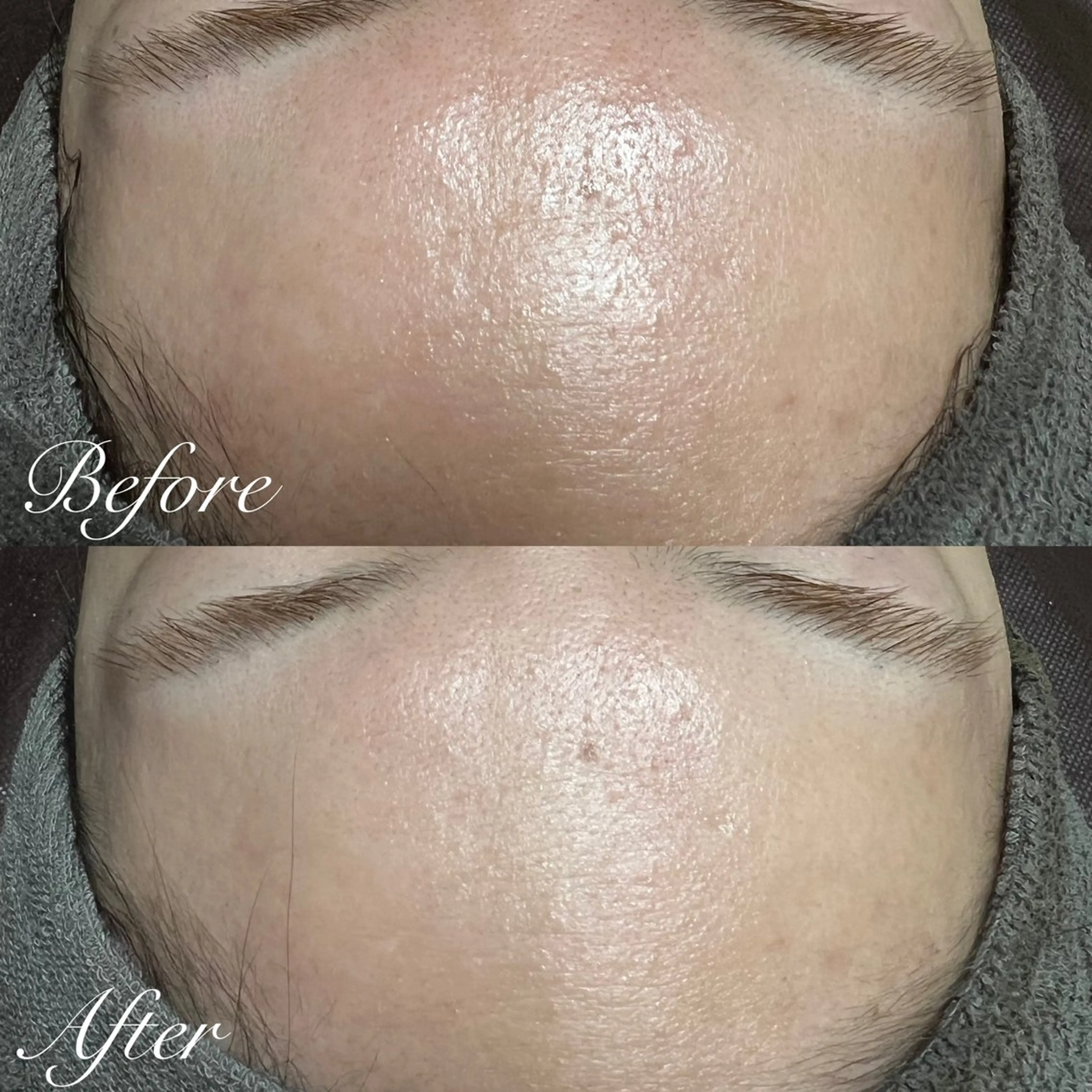 エステ シミ🩷ニキビ専門店 Matteo🎀✨のエステ・リラクイメージ