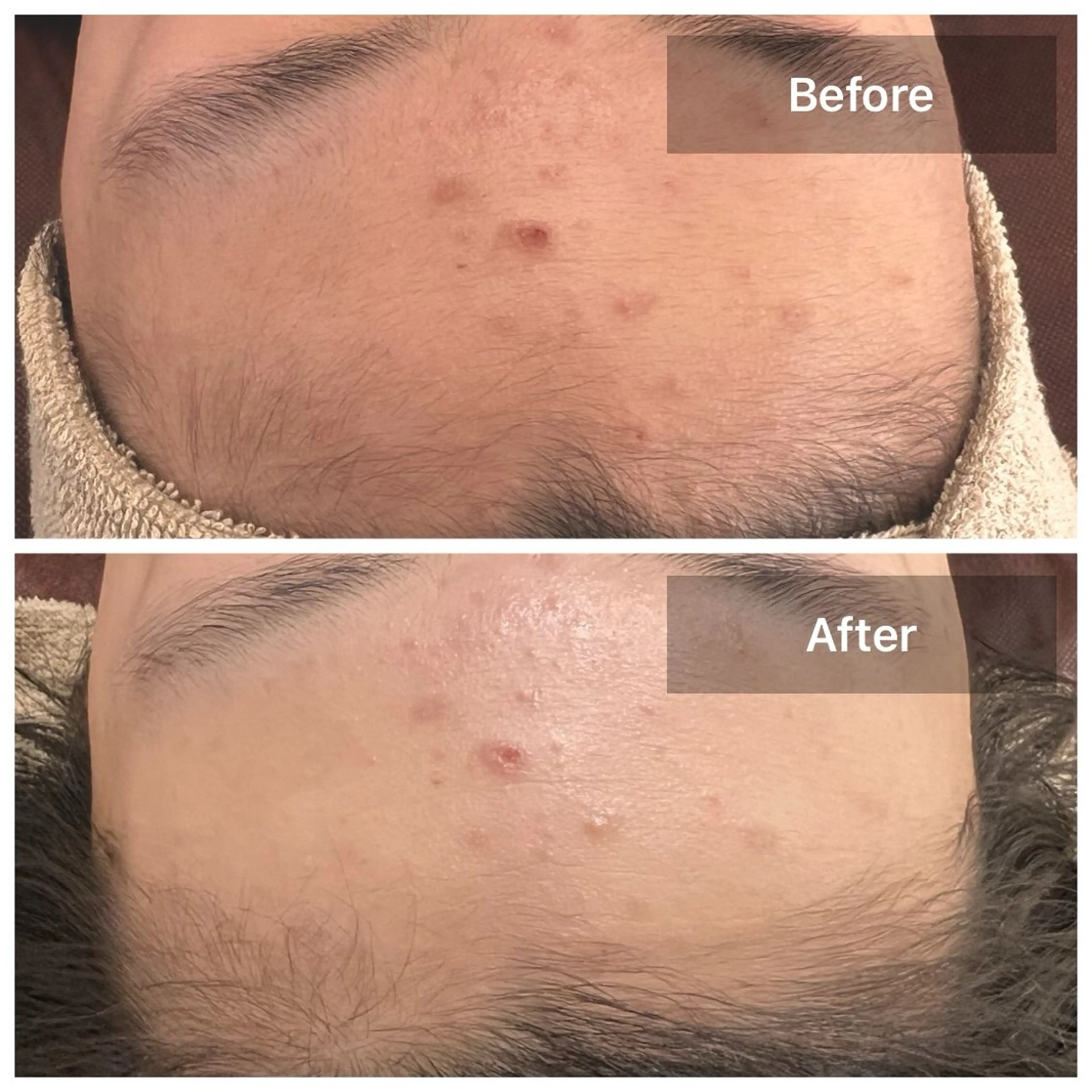 エステ Beauty salon LUNA所属・LUNA / Sakikoの眉毛・アイブロウイメージ