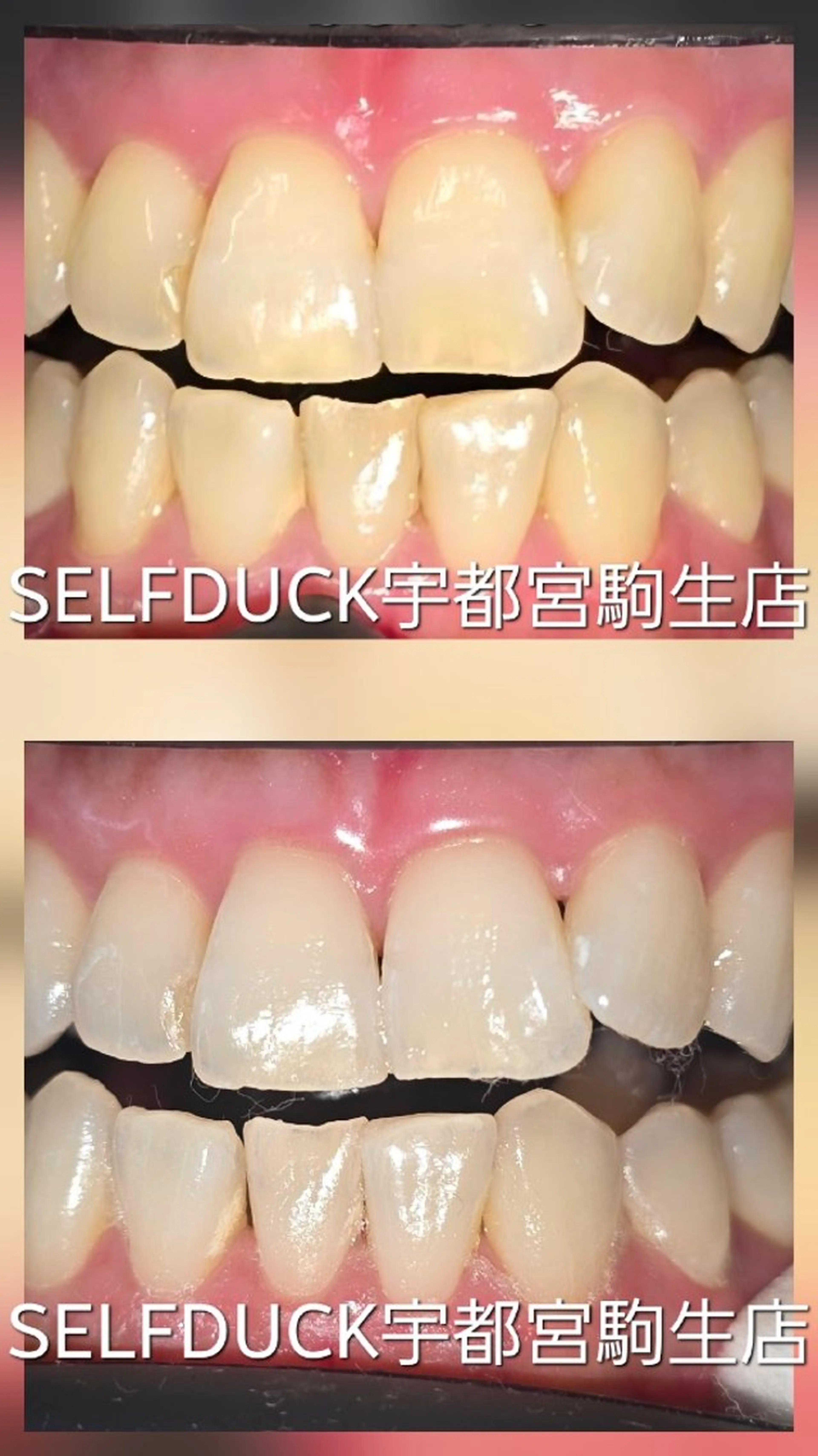 歯科提携セルフダック 宇都宮駒生店のエステ・リラクイメージ