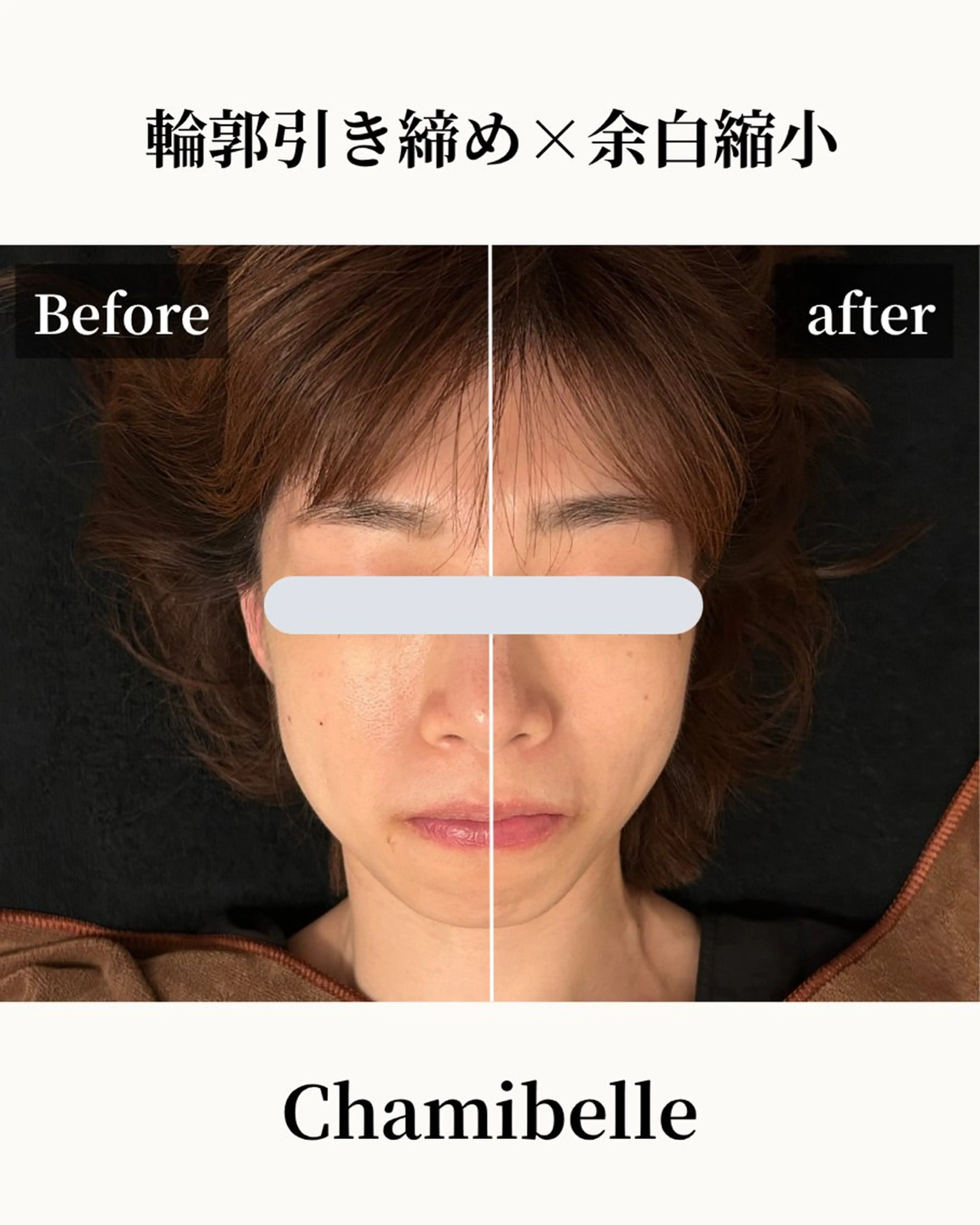 美容鍼灸サロン Chamibelleのエステ・リラクイメージ