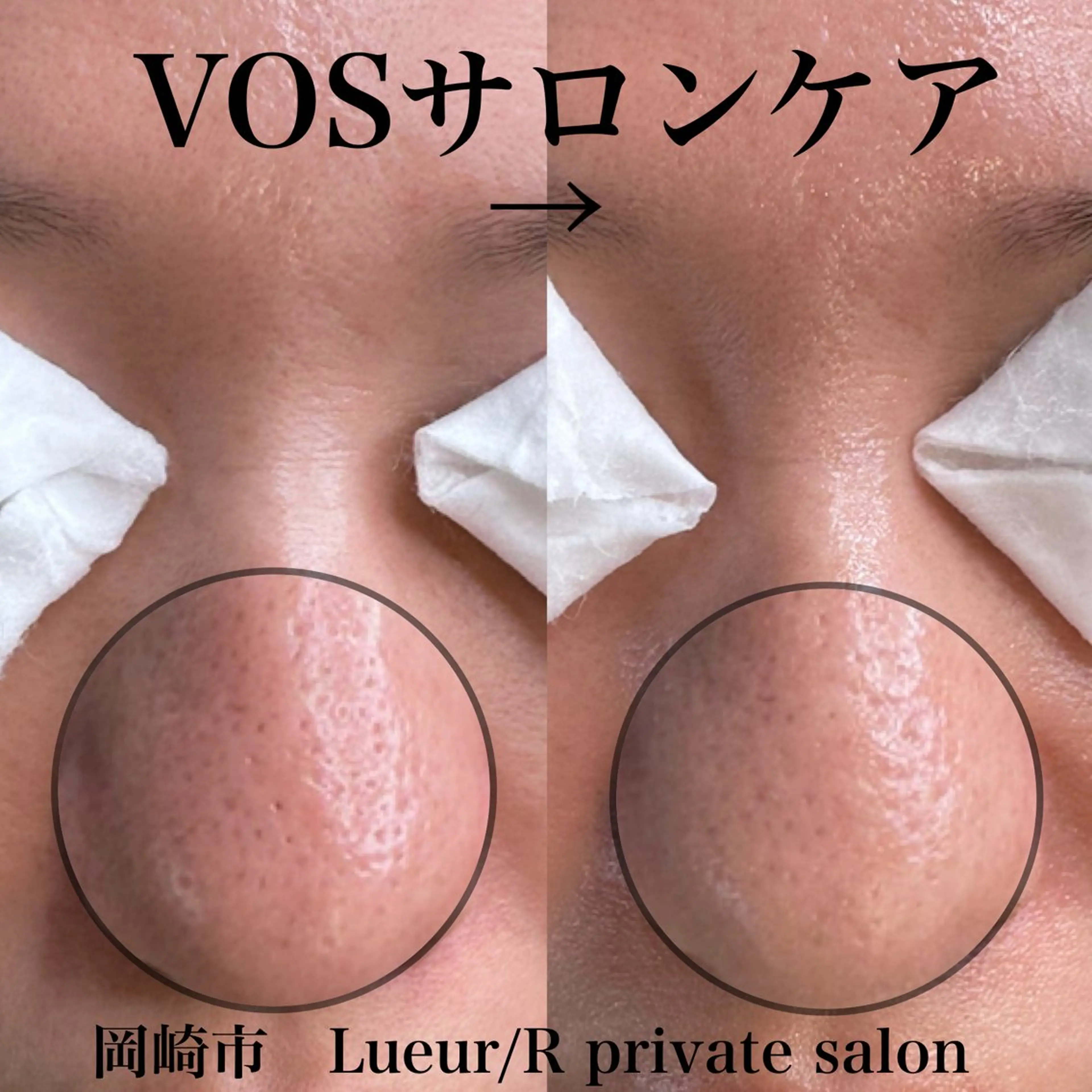 その他 大久保 里奈のエステ・リラクイメージ