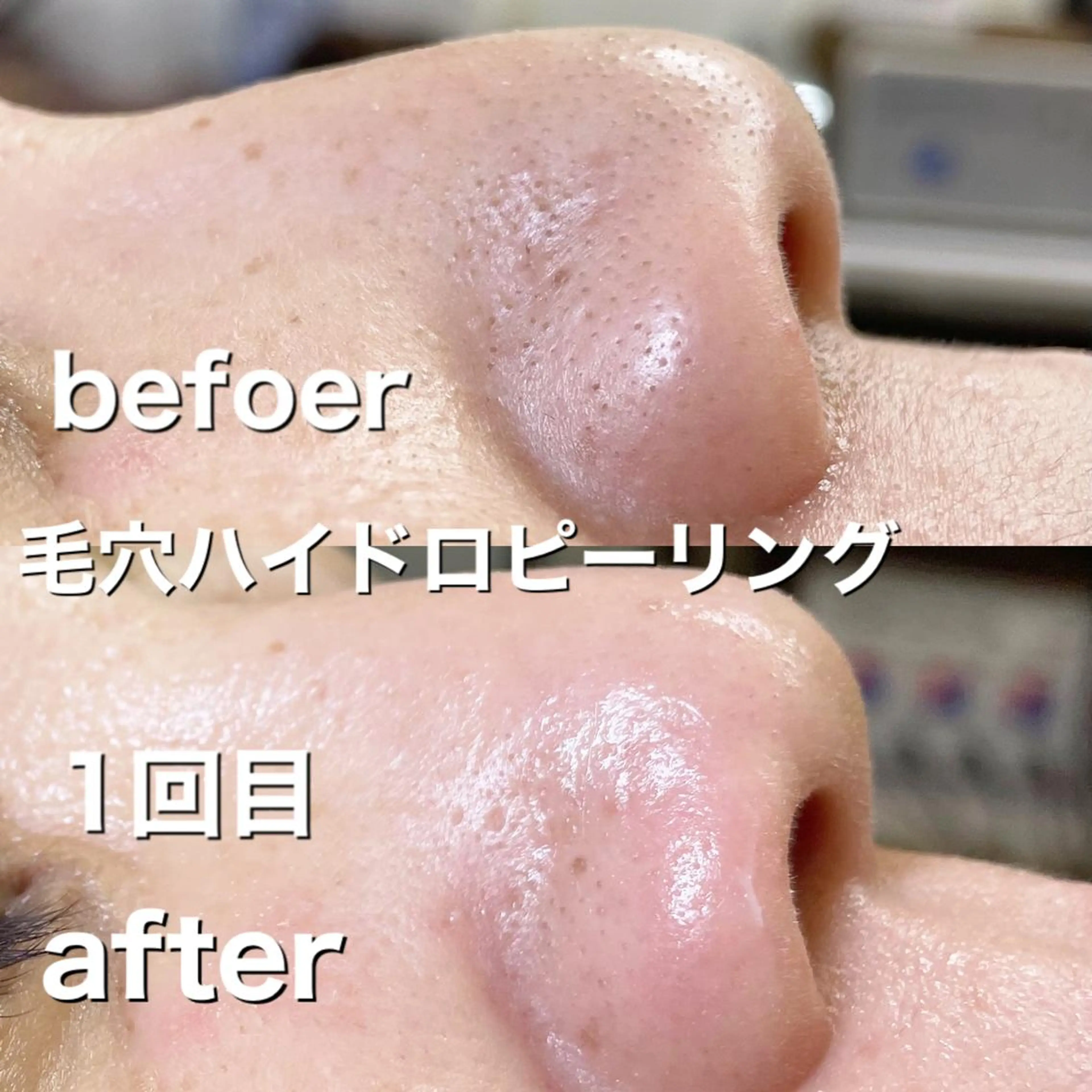 エステ エステサロンmagnolia所属・小野 優子の眉毛・アイブロウイメージ