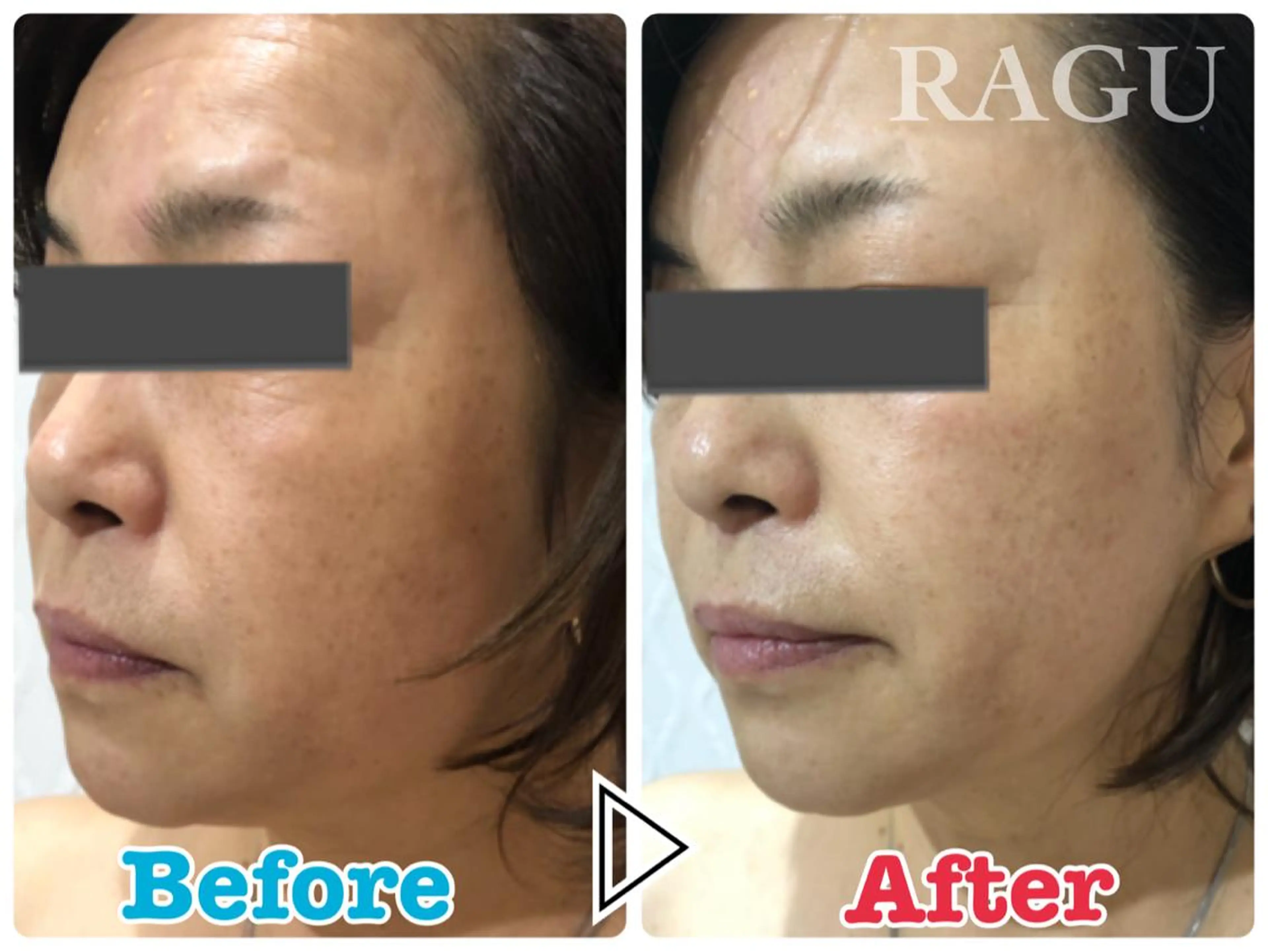 エステ リラク RAGU BEAUTY所属・原口 彩子のエステ・リラクイメージ