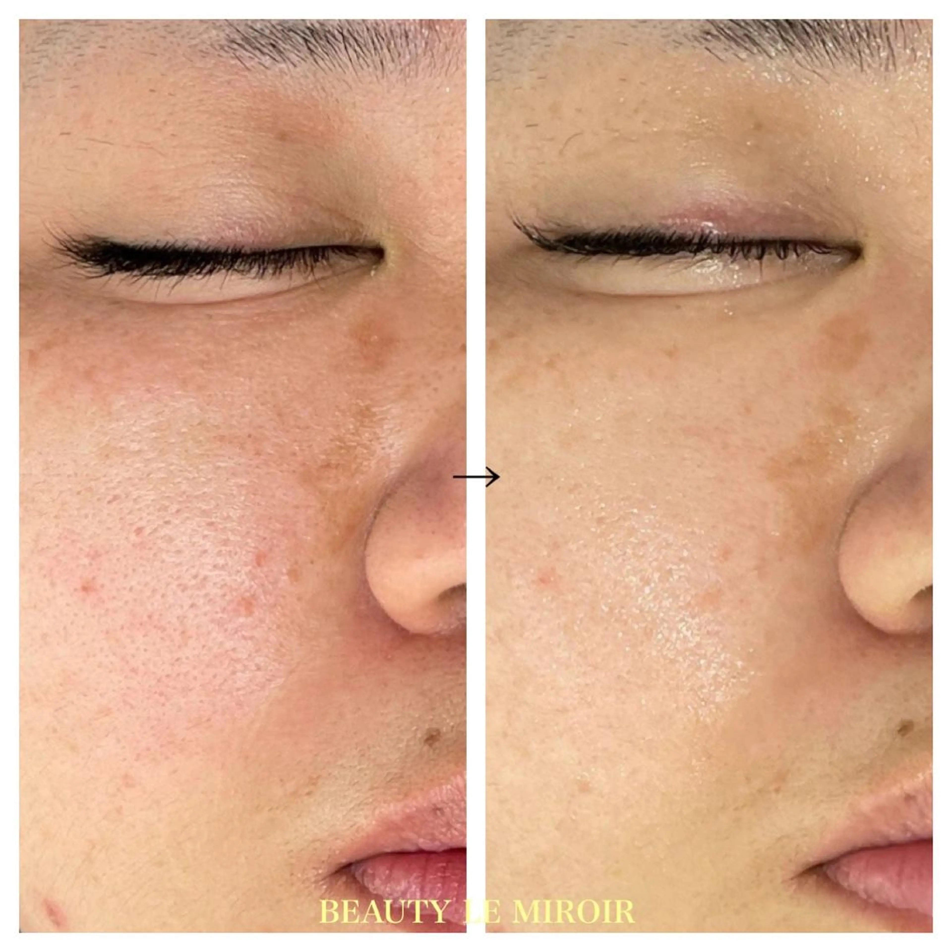 ビューティー ミロワールのエステ・リラクイメージ