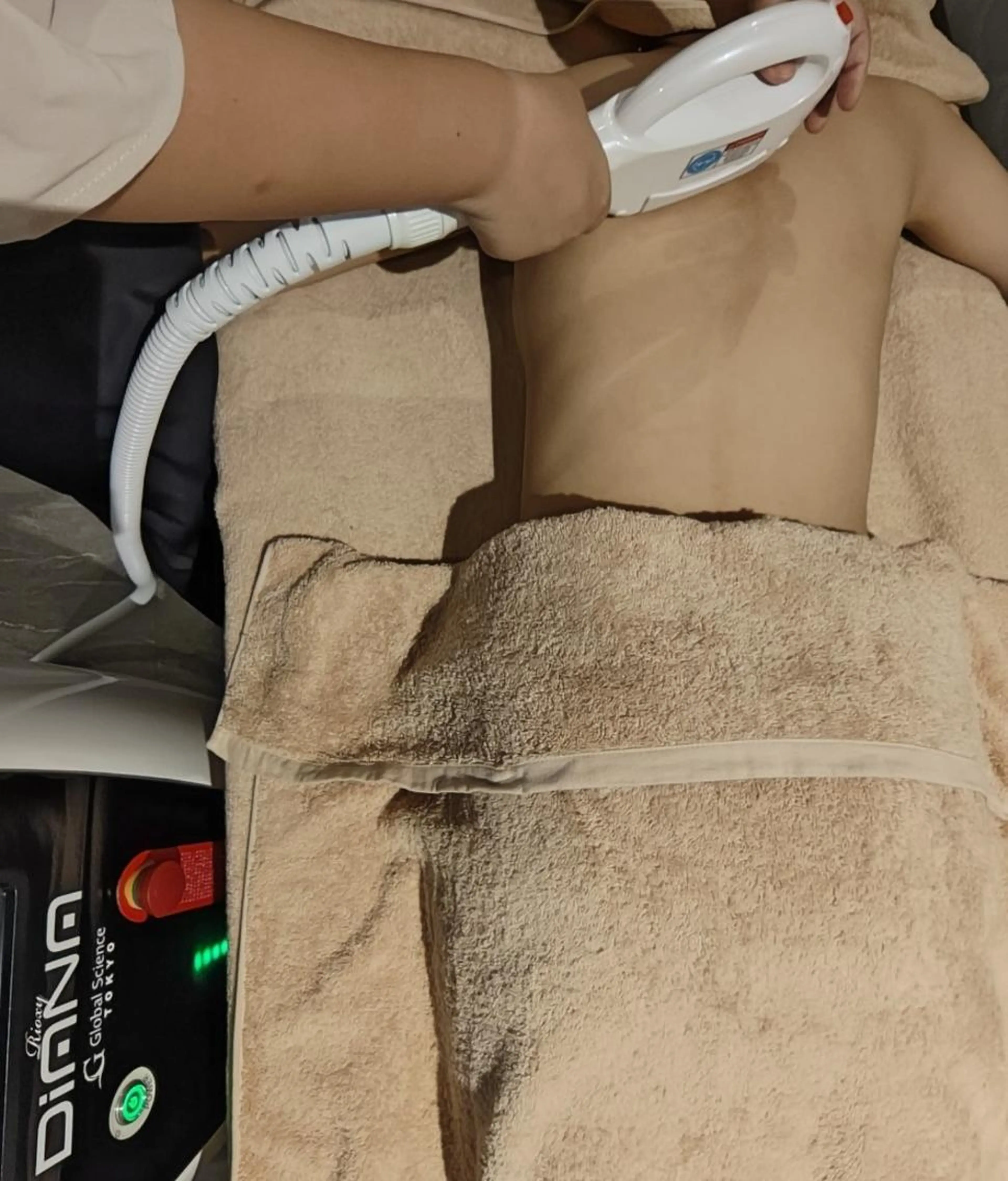 脱毛迷子さんに◎初めてでも安心！全身・顔・VIOまとめて美肌ケア脱毛¥7,980の写真