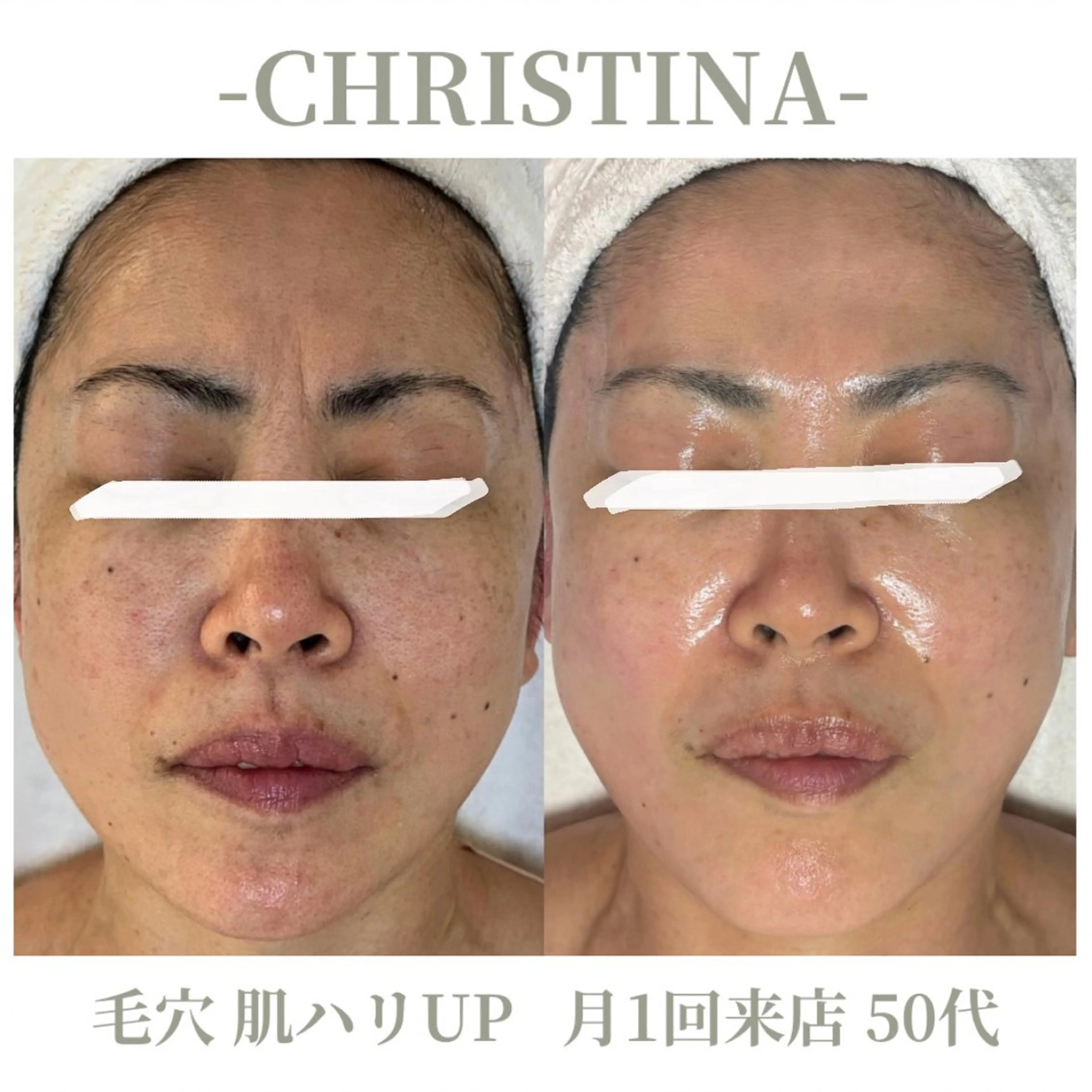 【たるみ・ハリ不足に🍷】年齢肌集中エイジングケア✦シャトーデボーテ |クリスティーナ天王寺・大阪💎の写真