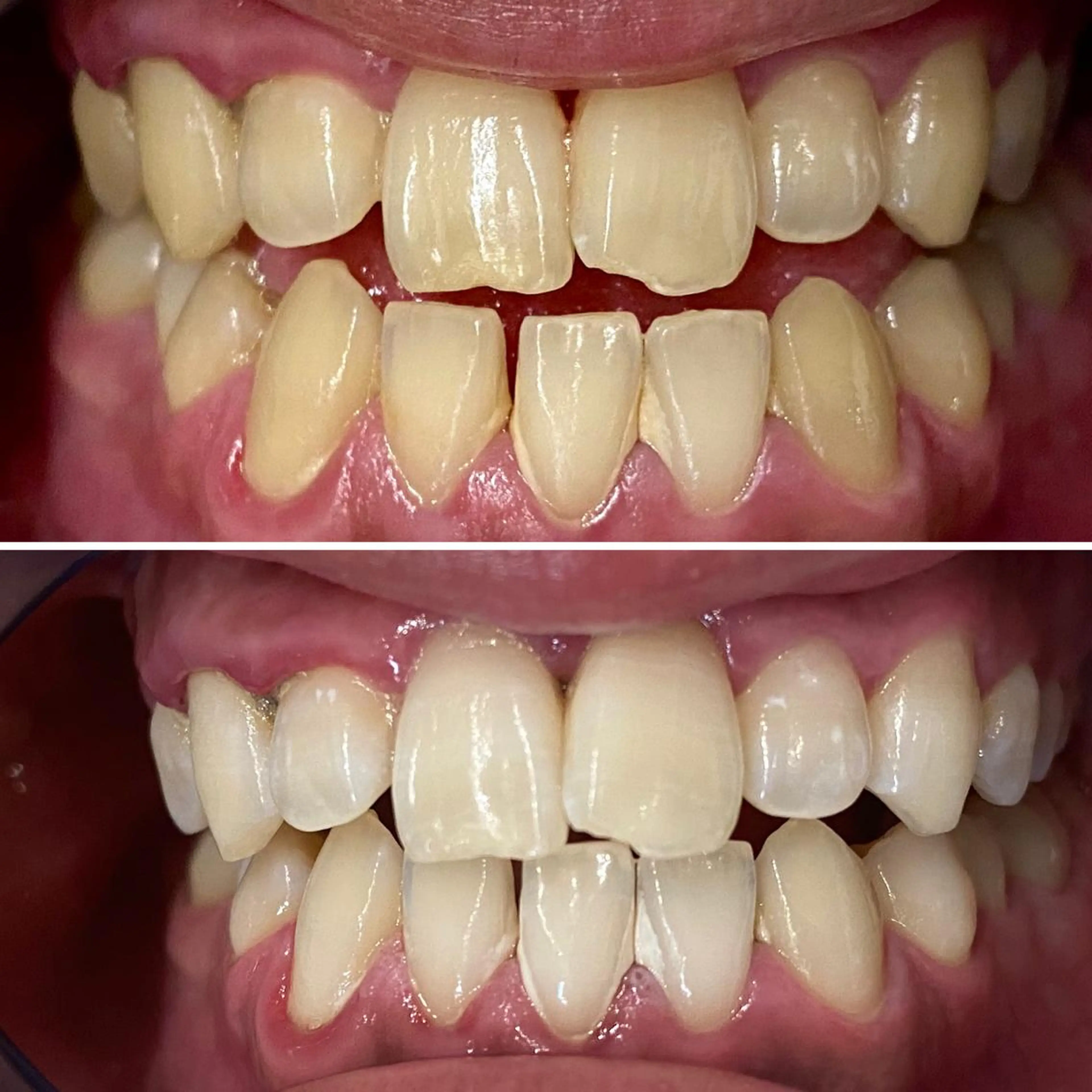 カラー メンズ キッズ ネイル マツエク・マツパ その他 ホワイトニング ⚓︎CREW柏⚓︎のその他イメージ