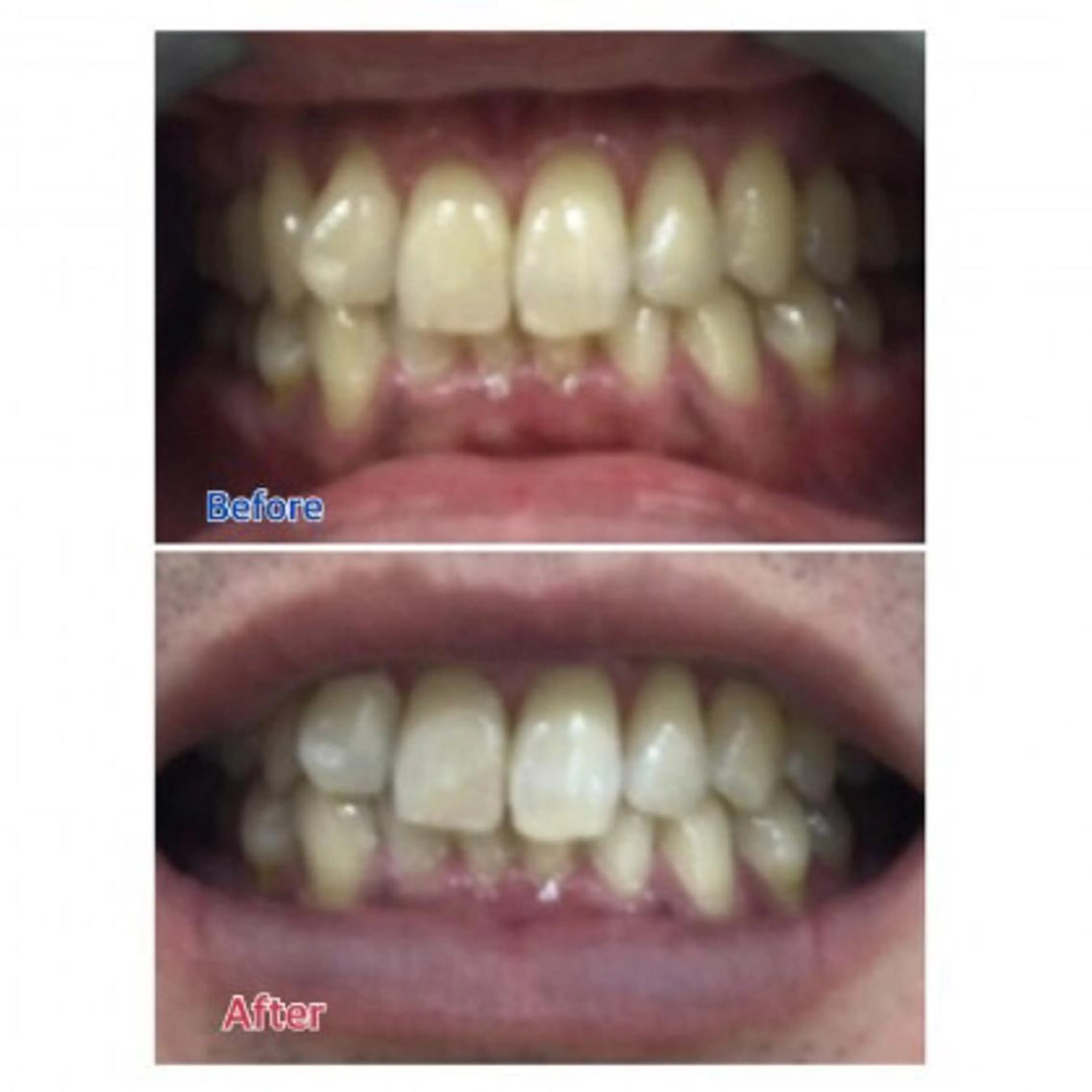 M渋谷店所属・Ｍ渋谷 ホワイトニングのエステ・リラクイメージ