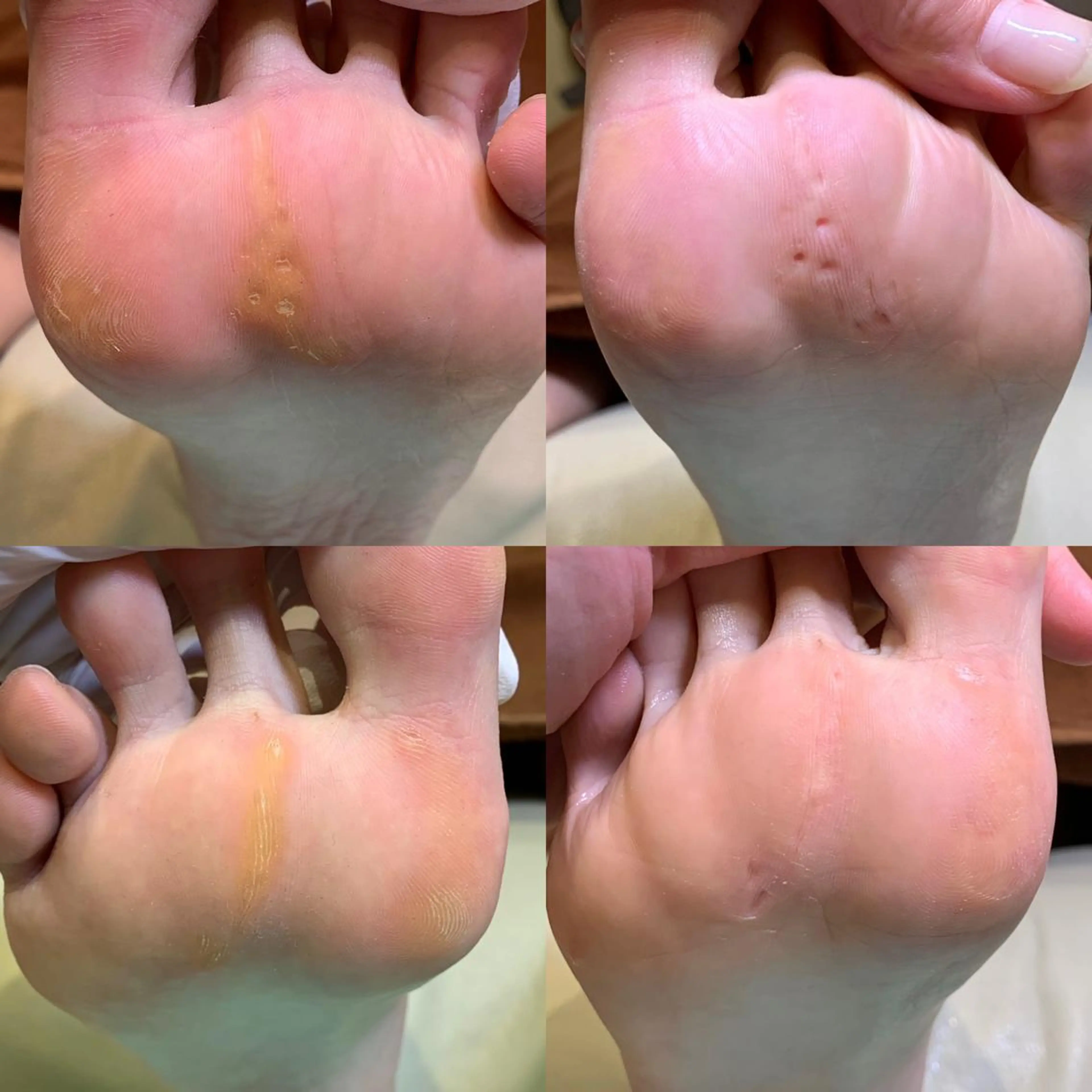 東京巻き爪アカデミー所属・東京巻き爪 アカデミーのエステ・リラクイメージ