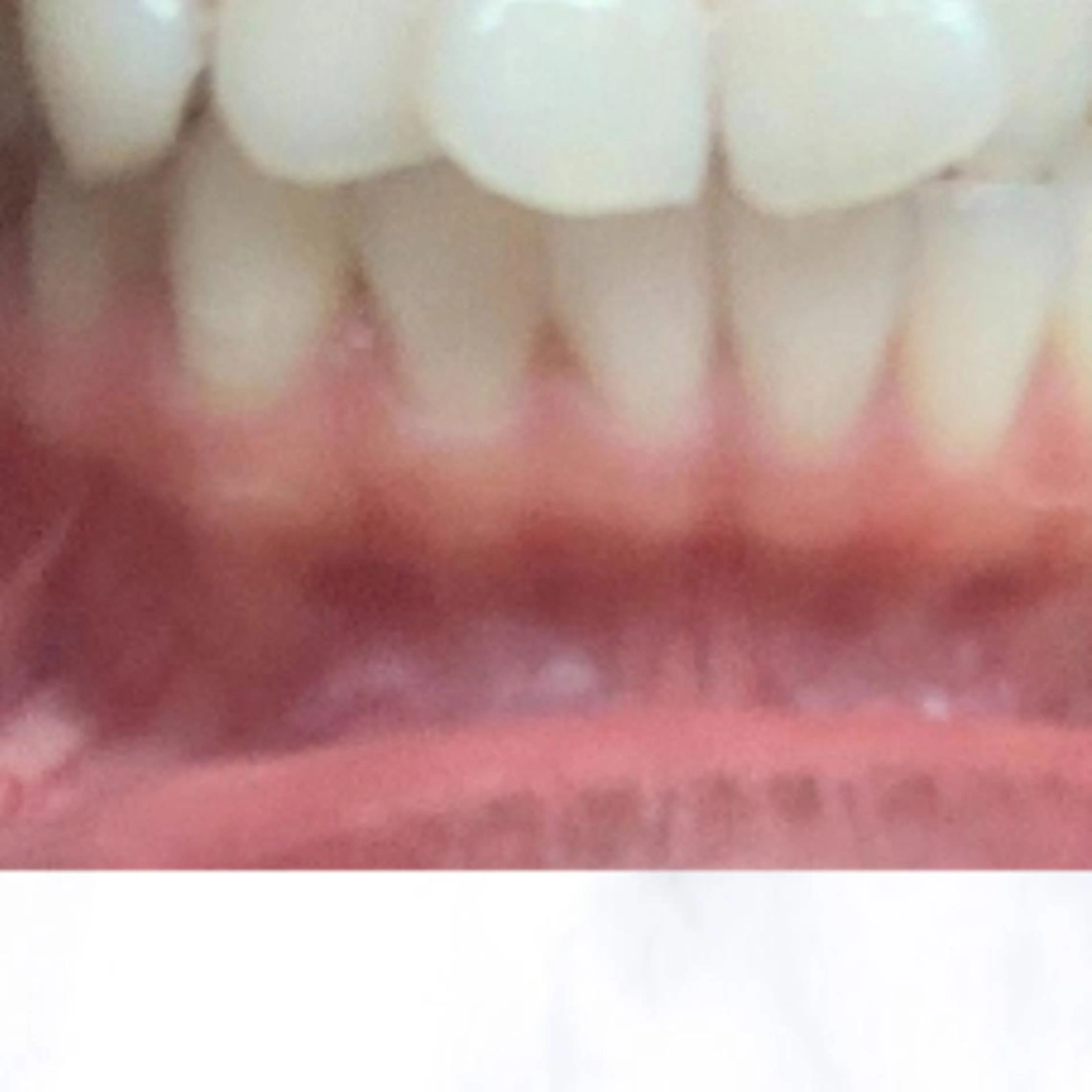 その他 ライトケアサロン 渋谷店② 渡邊のその他イメージ