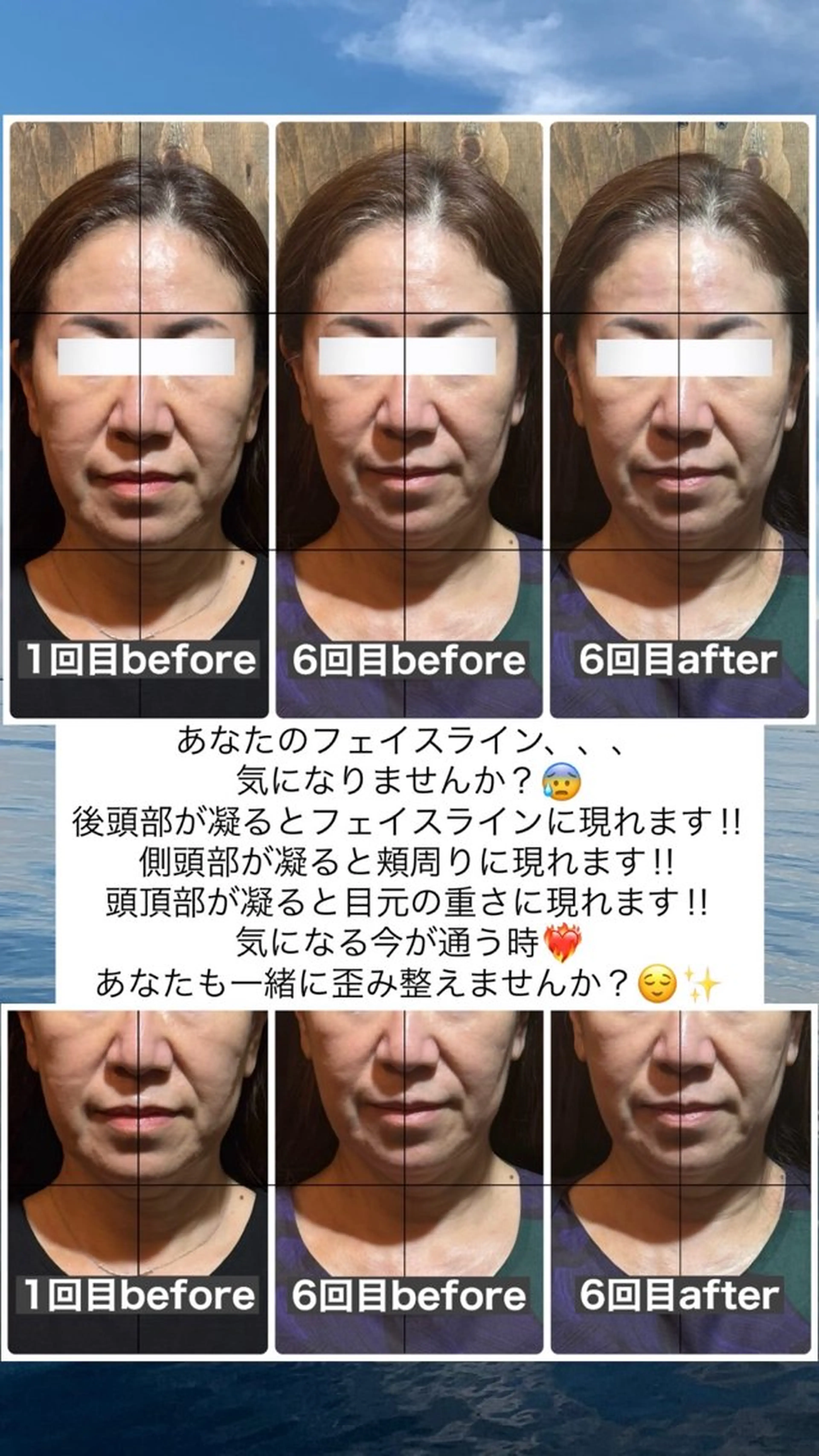 エステ リラク 💎後悔させない小顔 矯正💎イトヤマ🌱のエステ・リラクイメージ