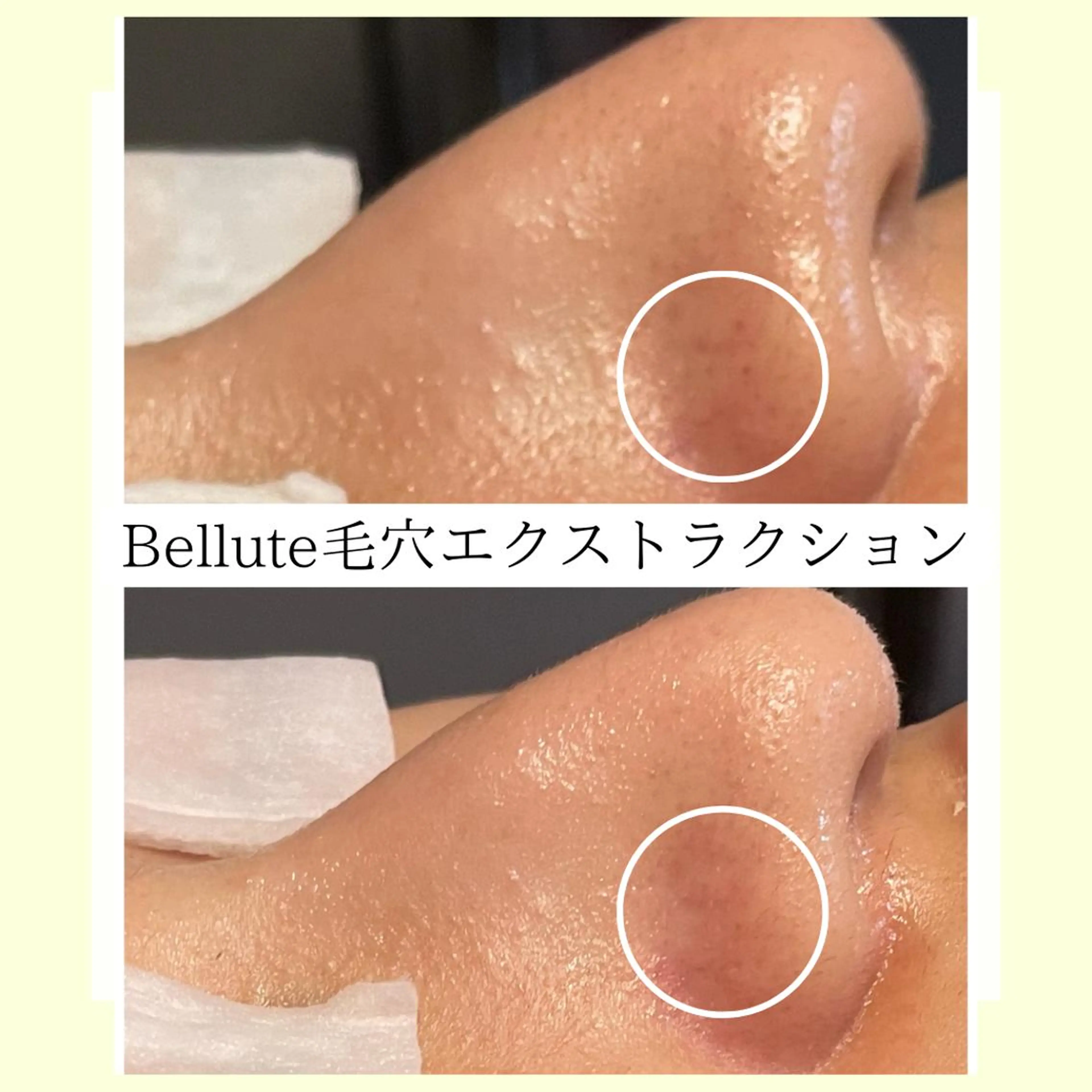 ピーリング専門店 Belluteのエステ・リラクイメージ