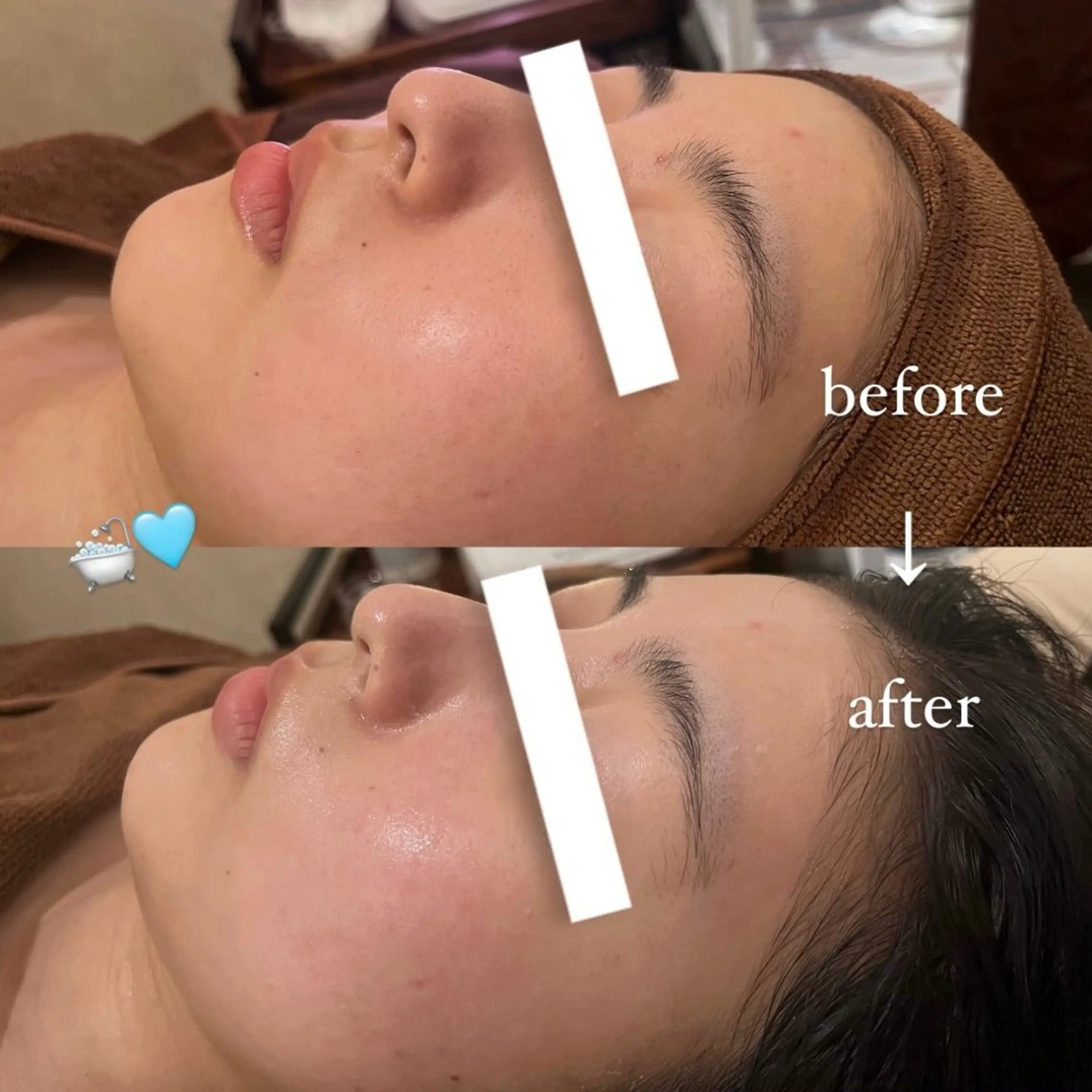 NOEL所属・フェイシャルエステ Utaiのエステ・リラクイメージ