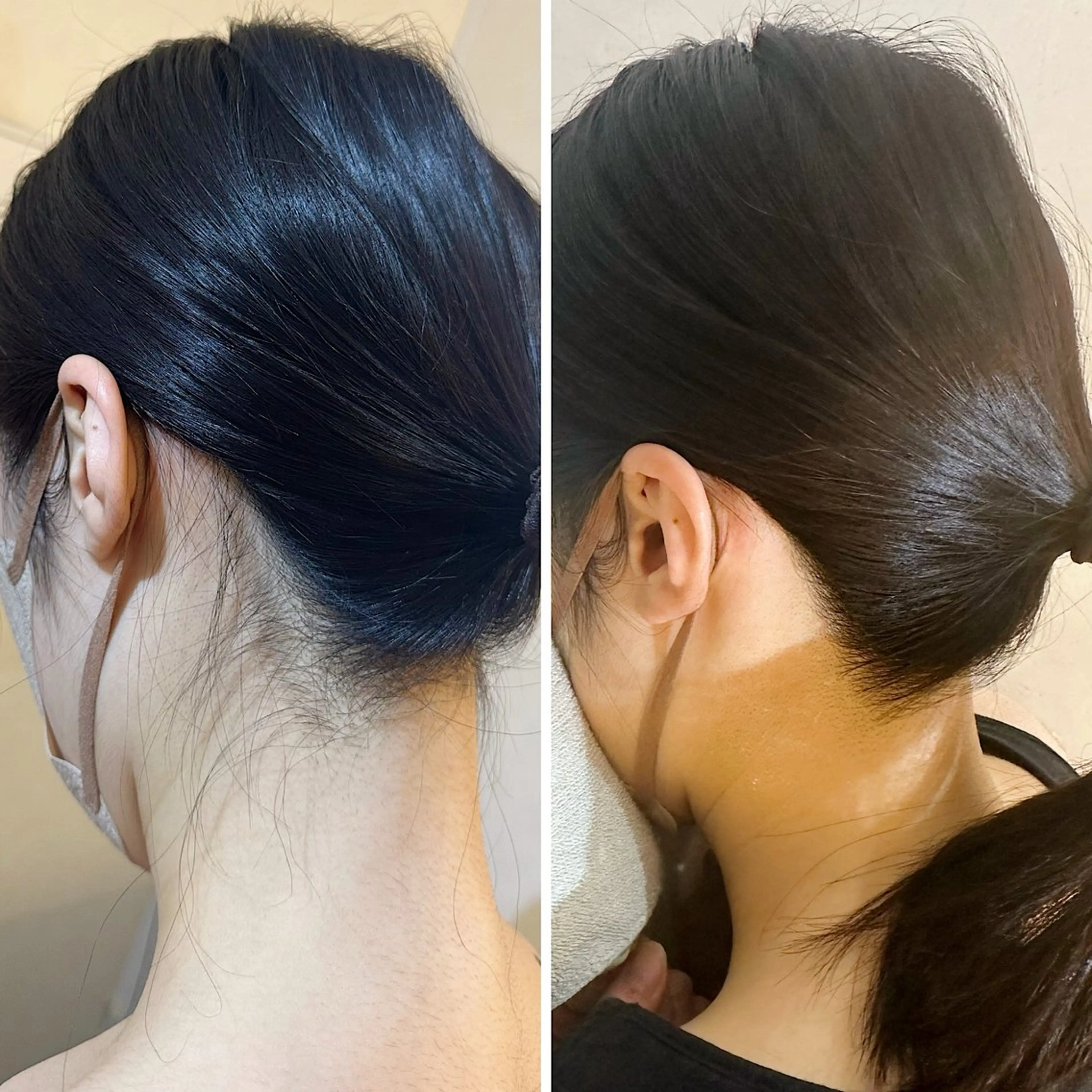 脱毛 うなじ脱毛/美肌脱毛 LABELのエステ・リラクイメージ