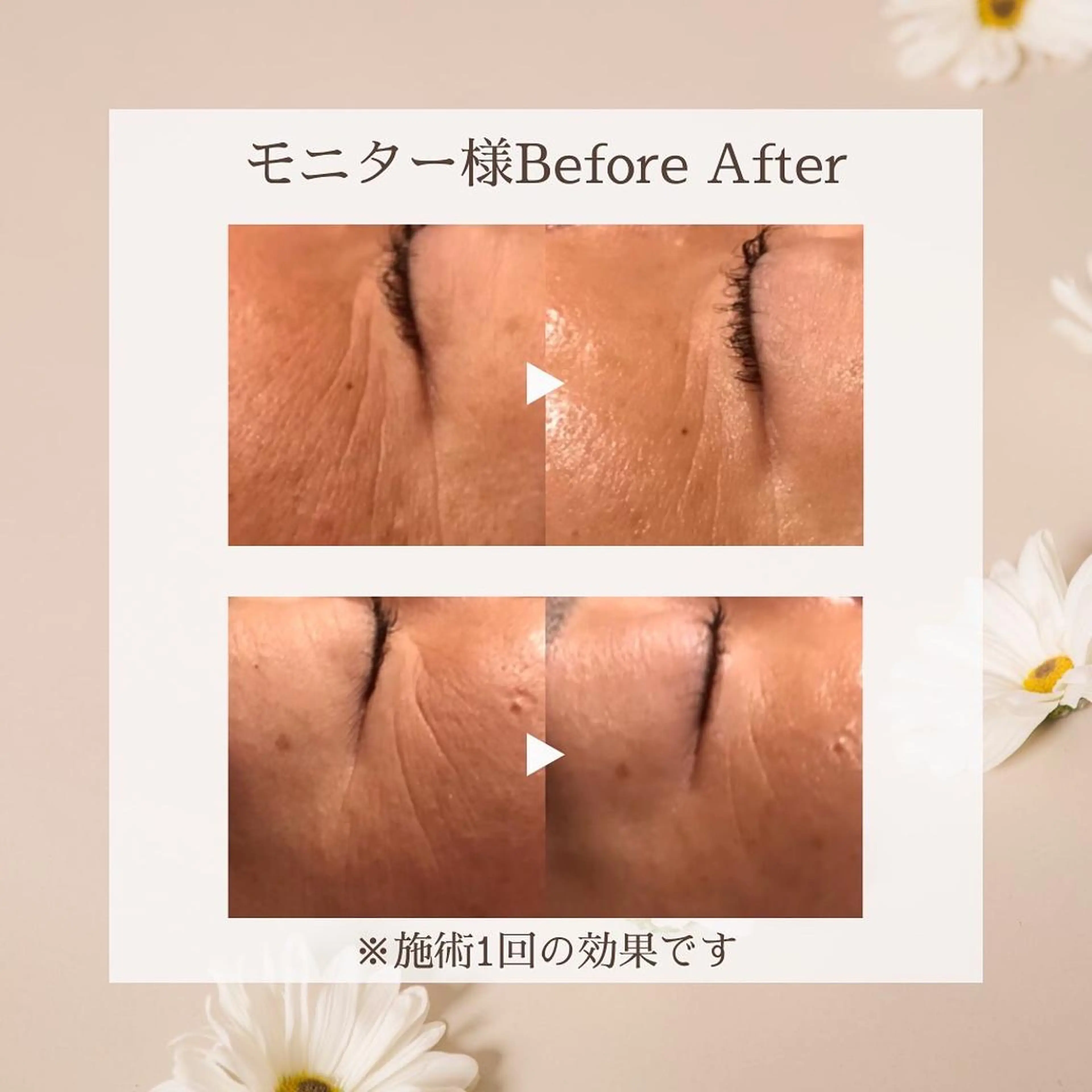 ゆか/エステサロン Lilasmileのエステ・リラクイメージ