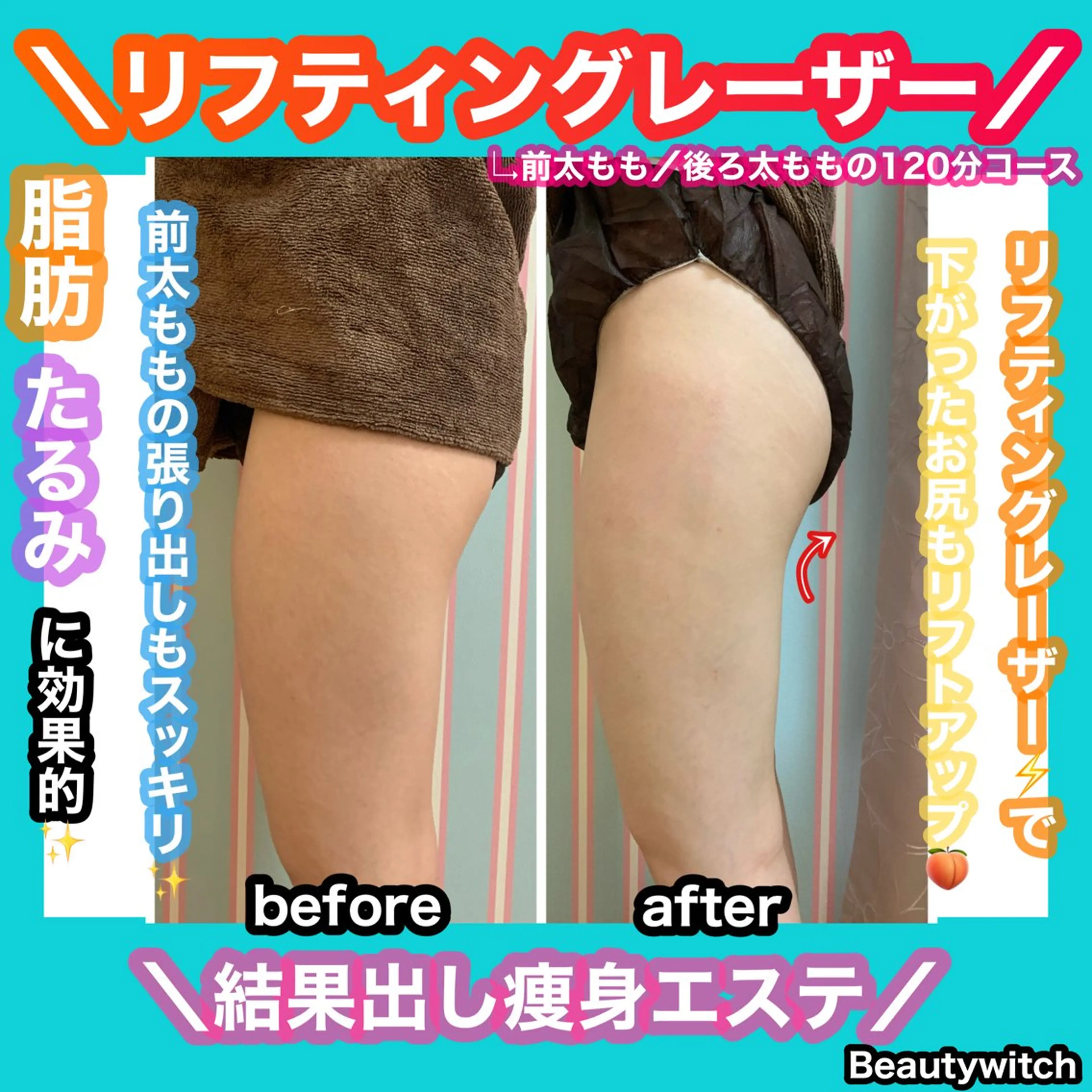 エステ 痩身/脱毛/ネイル HARUKAのエステ・リラクイメージ