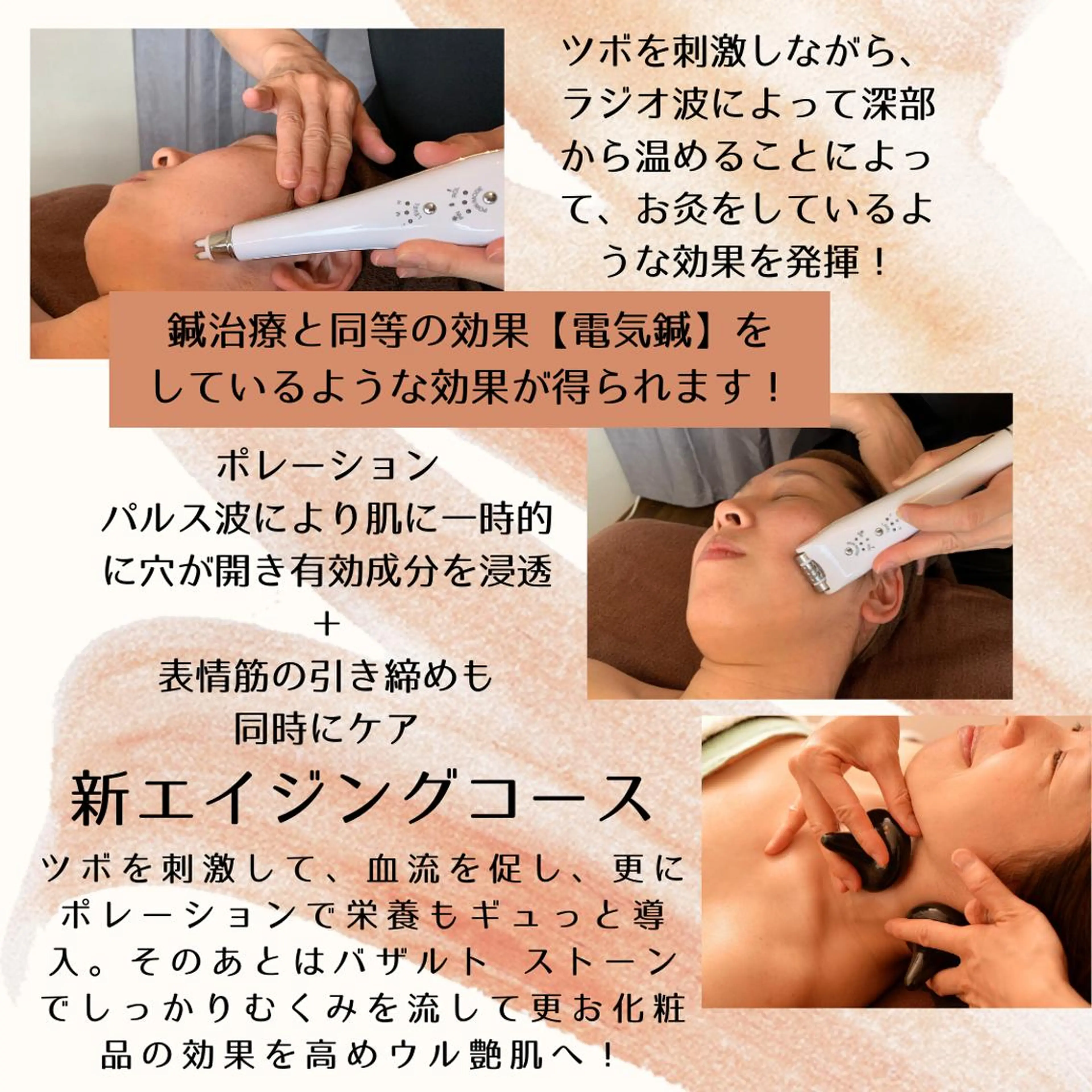 【モニター限定5名：口コミ投稿写真必須】新メニュー：エイジングコース体験　美容液のポレーション、高濃度パック付き！の写真