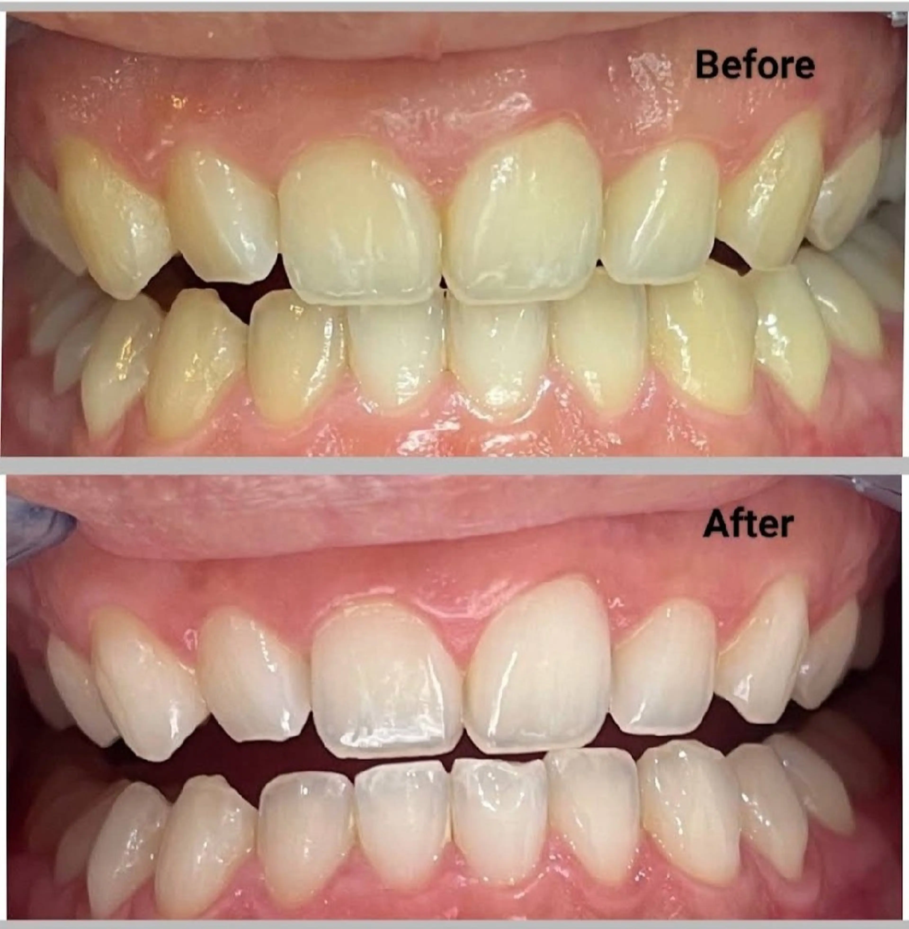 アイラッシュサロン ミノのマツエク・マツパデザイン