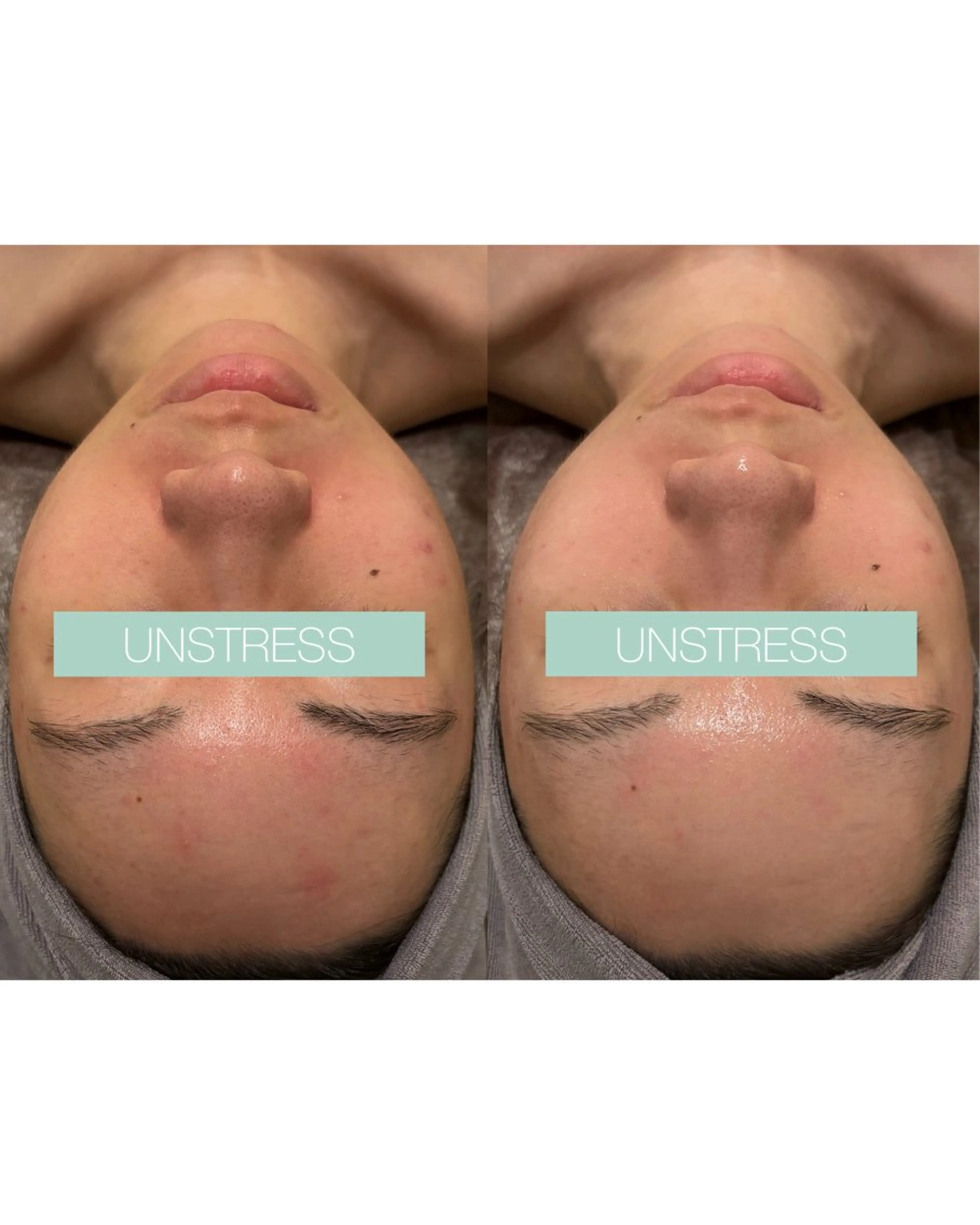 ☆痩身/小顔☆ 結果出します☆のエステ・リラクイメージ