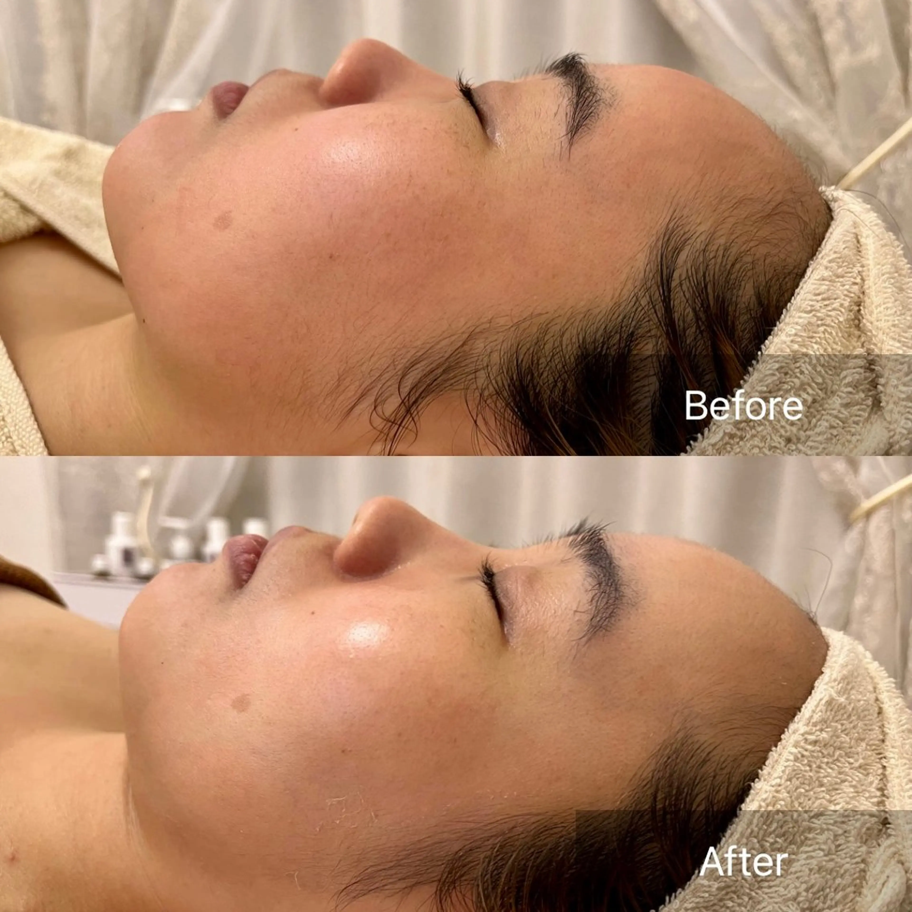 肌質改善サロン renew所属・肌質改善サロン renew/ｳｴｷのエステ・リラクイメージ