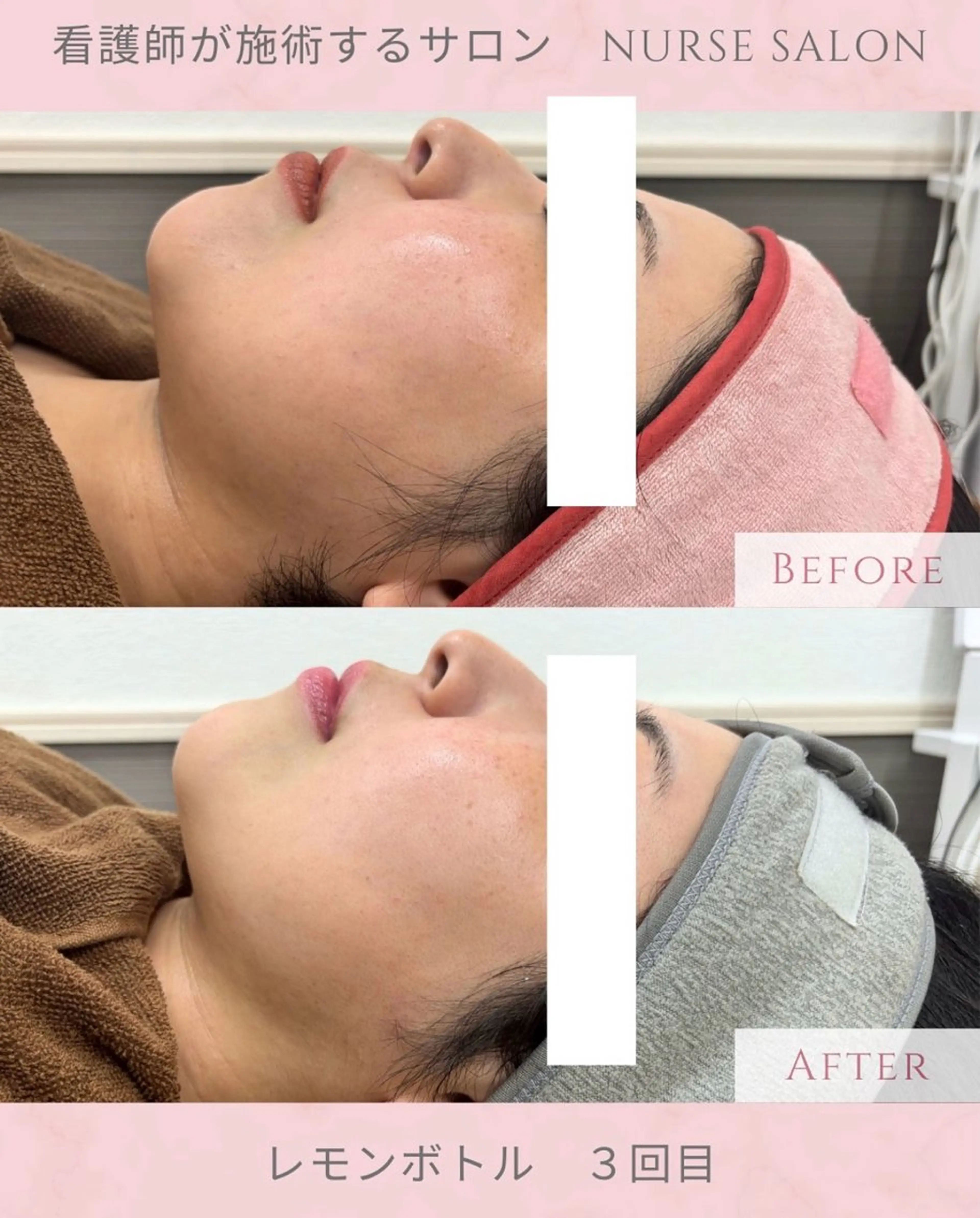 ナスサロ/看護師 おおほり🐰🫧のエステ・リラクイメージ