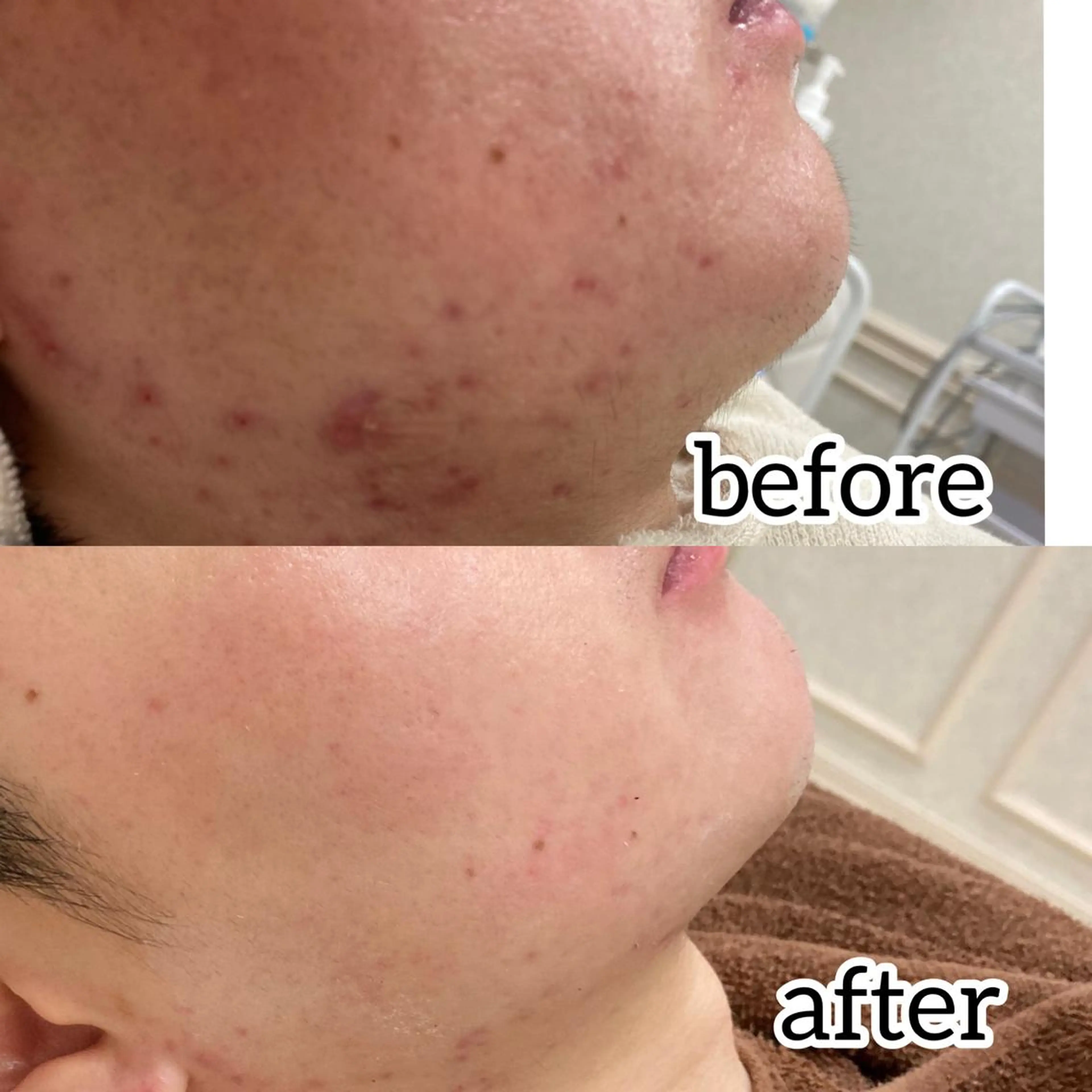 laluna saki...のその他イメージ