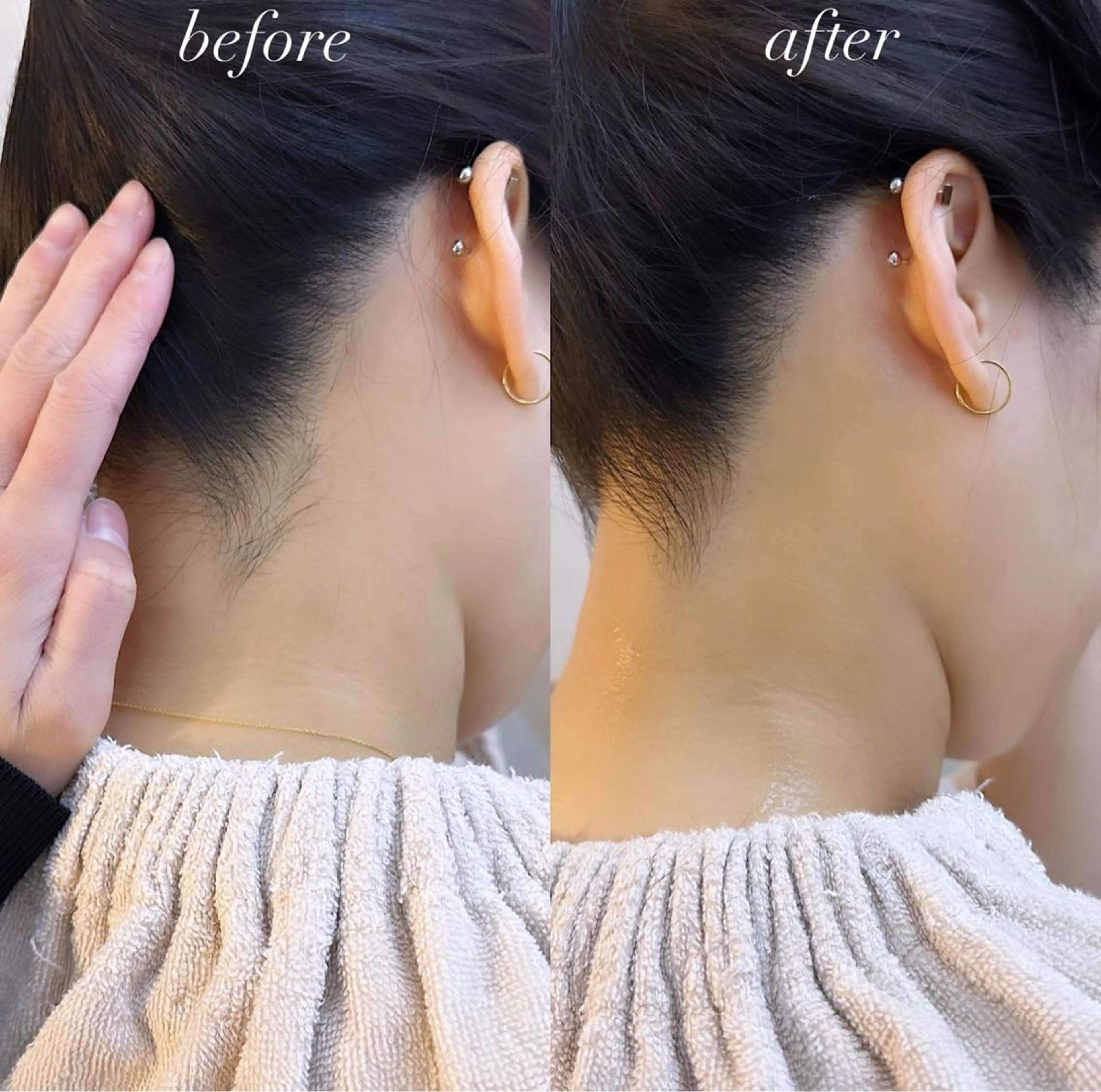 うなじ脱毛/美肌脱毛 LABELのエステ・リラクイメージ