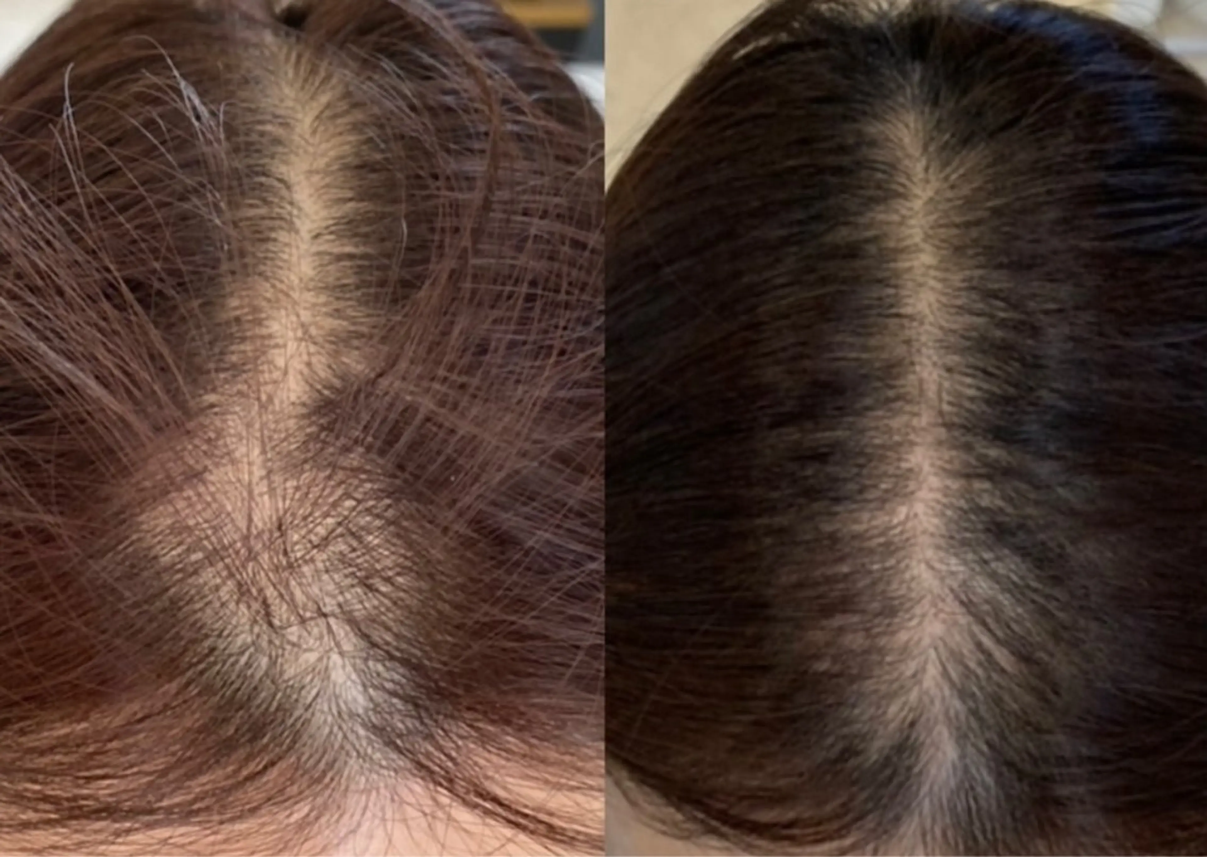 【福岡市西区 エステ】 GRANVIR(グランヴィール)所属・GRANVIR グランヴィールのエステ・リラクイメージ