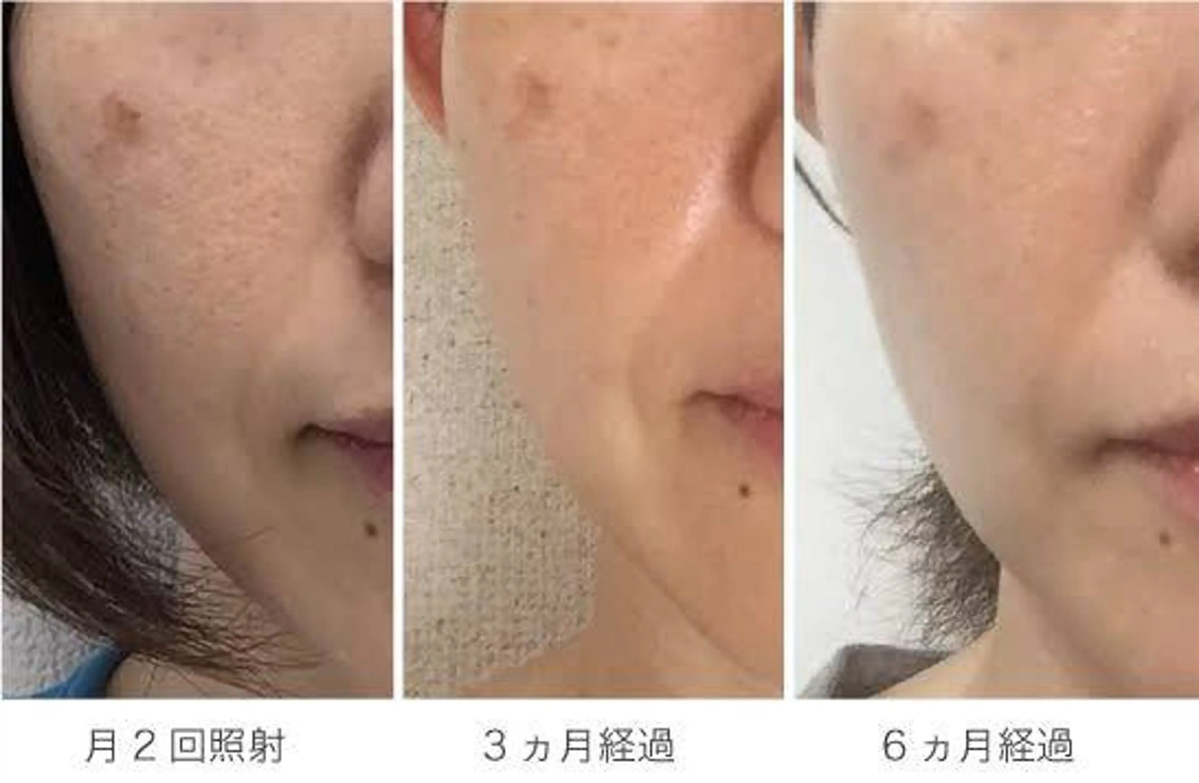 MyFairLady miuのエステ・リラクイメージ