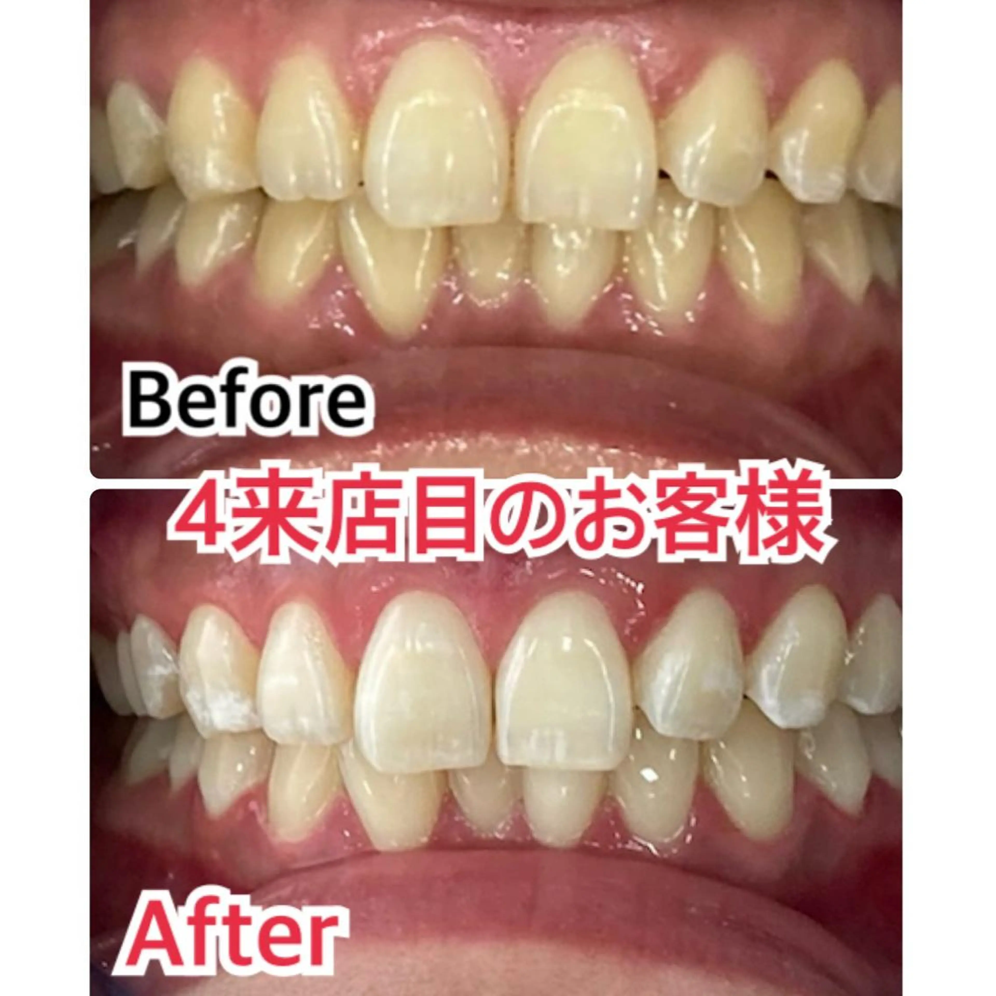 プラチナムビューティー柏所属・【歯科提携】柏ホワイ トニングスタイルのその他イメージ