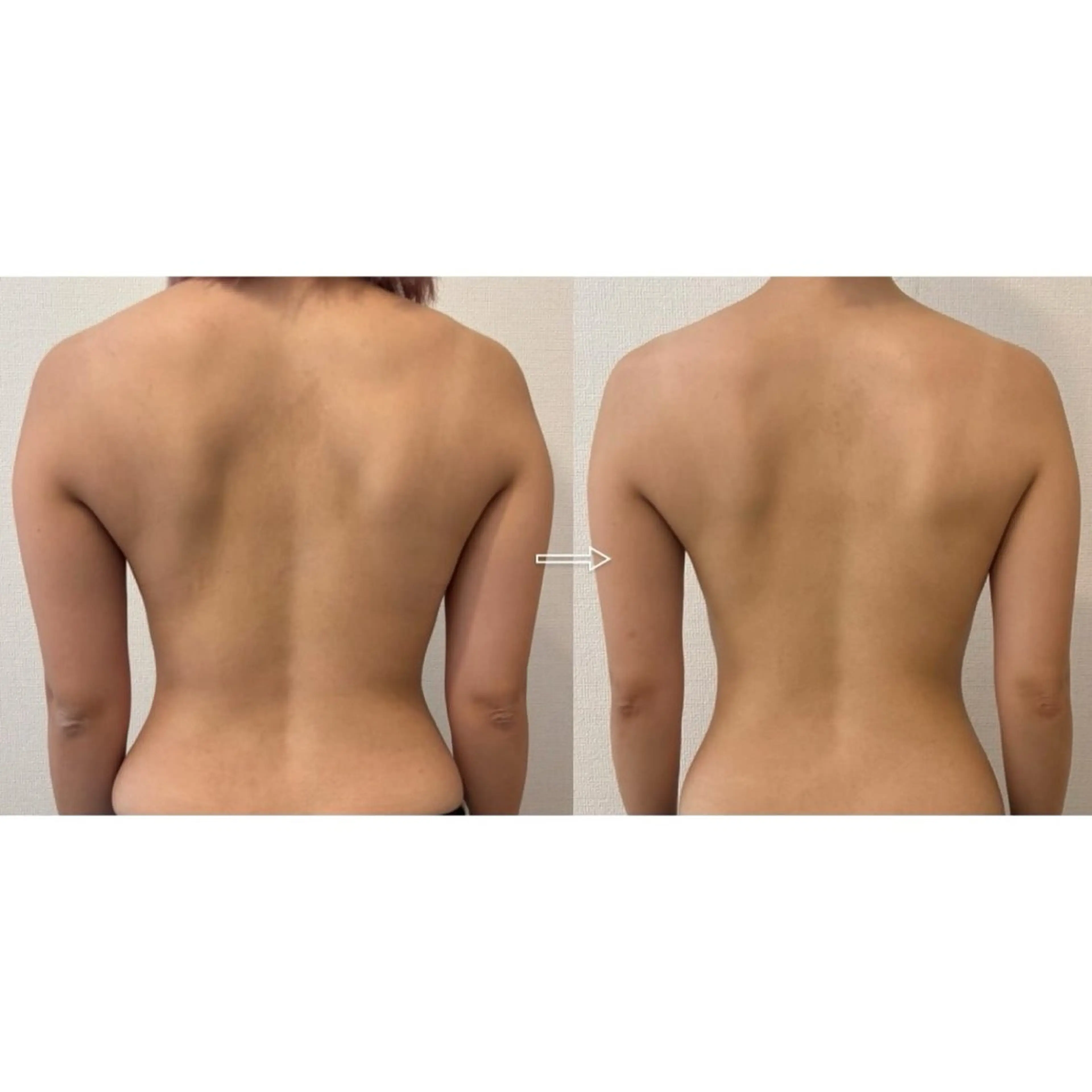 【ミニモ限定】美肌全身リンパマッサージ80分の写真