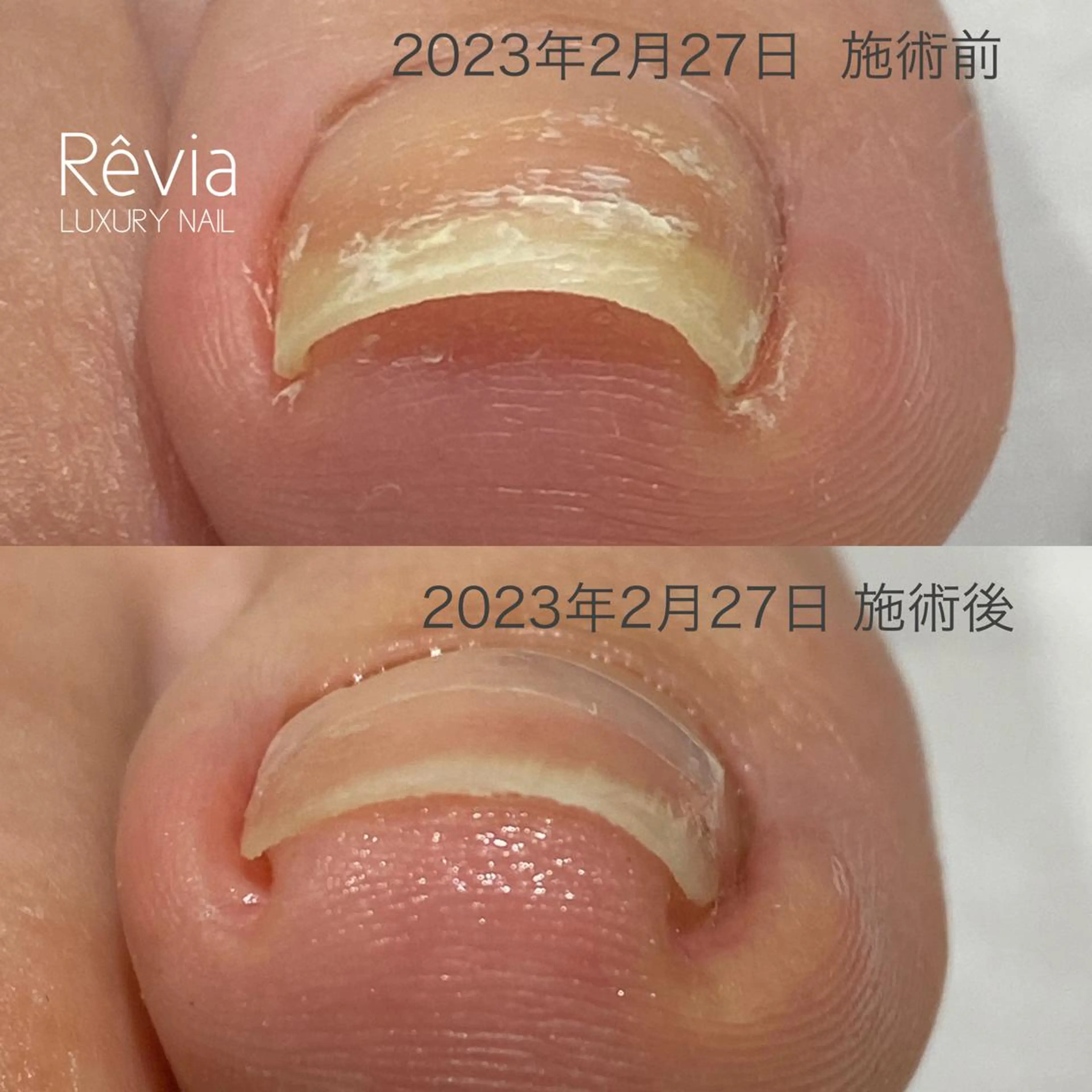 ネイル フットネイル プライベートサロン Rのネイルデザイン