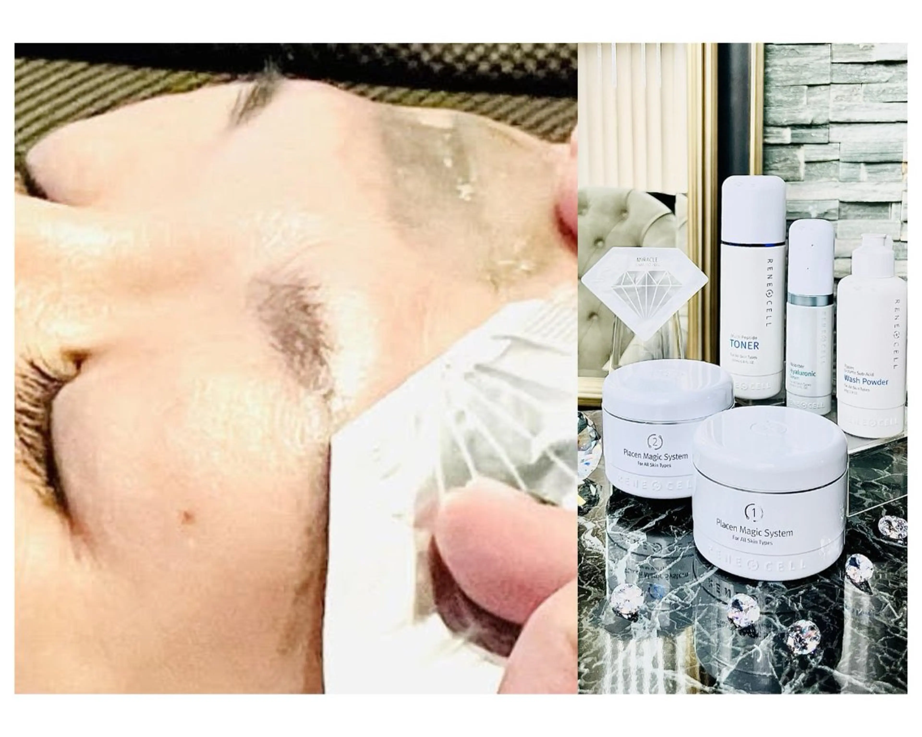 ダイヤモンドピールプログラムの写真